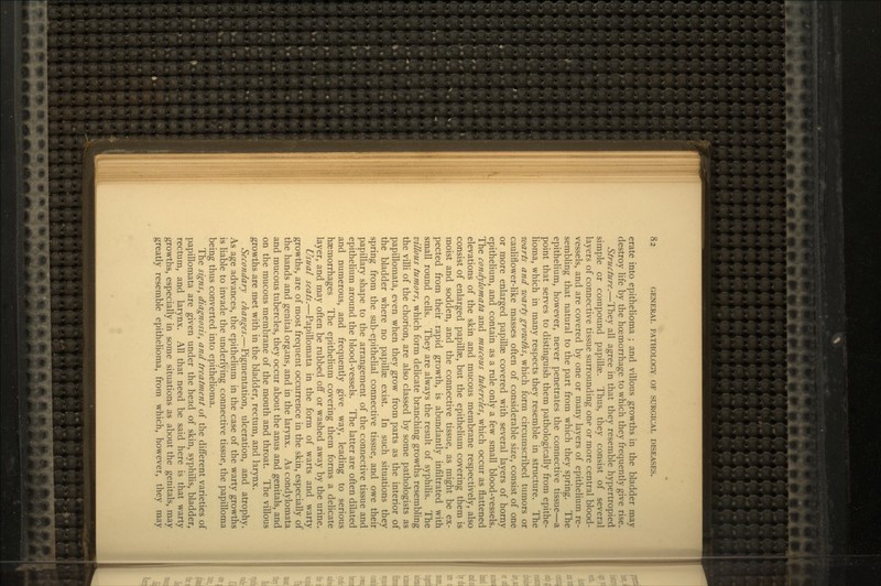 erate into epithelioma ; and villous growths in the bladder may destroy life by the hoemorrhage to which they frequently give rise. Structure.—They all agree in that they resemble hypertropied simple or compound papillae. Thus, they consist of several layers of connective tissue surrounding one or more central blood- vessels, and are covered by one or many layers of epithelium re- sembling that natural to the part from which they spring. The epithelium, however, never penetrates the connective tissue—a point that serves to distinguish them pathologically from epithe- lioma, which in many respects they resemble in structure. The warts and warty growths, which form circumscribed tumors or cauliflower-like masses often of considerable size, consist of one or more enlarged papillae covered with several layers of horny epithelium, and contain as a rule only a few small blood-vessels. The condylomata and mucous tubercles, which occur as flattened elevations of the skin and mucous membrane respectively, also consist of enlarged papillae, but the epithelium covering them is moist and sodden, and the connective tissue, as might be ex- pected from their rapid growth, is abundantly infiltrated with small round cells. They are always the result of syphilis. The villous tumors, which form delicate branching growths resembling the villi of the chorion, are also classed by some pathologists as papillomata, even when they grow from parts as the interior of the bladder where no papillae exist. In such situations they spring from the sub-epithelial connective tissue, and owe their papillary shape to the arrangement of the connective tissue and epithelium around the blood-vessels. The latter are often dilated and numerous, and frequently give way, leading to serious haemorrhages The epithelium covering them forms a delicate layer, and may often be rubbed off or washed away by the urine. Usual seats.—Papillomata in the form of warts and warty growths, are of most frequent occurrence in the skin, especially of the hands and genital organs, and in the larynx. As condylomata and mucous tubercles, they occur about the anus and genitals, and on the mucous membrane of the mouth and throat. The villous growths are met with in the bladder, rectum, and larynx. Secondary changes.—Pigmentation, ulceration, and atrophy. As age advances, the epithelium in the case of the warty growths is liable to invade the underlying connective tissue, the papilloma being thus converted into epithelioma. The signs, diagnosis, and treatment of the different varieties of papillomata are given under the head of skin, syphilis, bladder, rectum, and larynx. All that need be said here is that warty growths, especially in some situations as about the genitals, may greatly resemble epithelioma, from which, however, they may