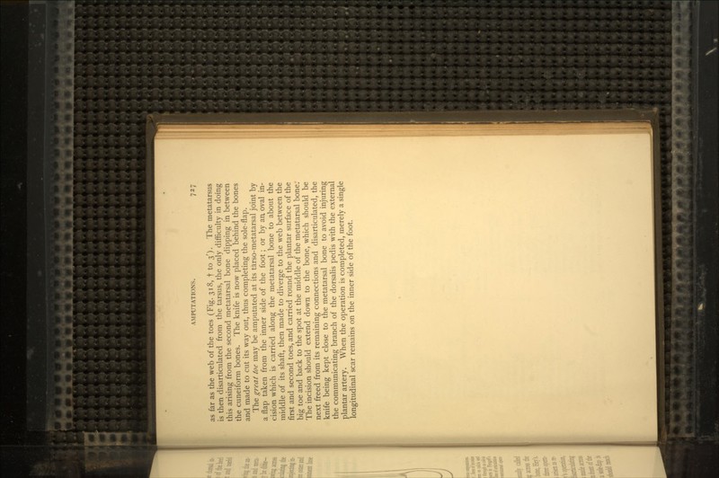 as far as the web of the toes (Fig. 318, f to 3'). The metatarsus is then disarticulated from the tarsus, the only difficulty in doing this arising from the second metatarsal bone dipping in between the cuneiform bones. The knife is now placed behind the bones and made to cut its way out, thus completing the sole-flap. The great toe may be amputated at its tarso-metatarsal joint by a flap taken from the inner side of the foot; or by an, oval in- cision which is carried along the metatarsal bone to about the middle of its shaft, then made to diverge to the web between the first and second toes, and carried round the plantar surface of the big toe and back to the spot at the middle of the metatarsal bone: The incision should extend down to the bone, which should be next freed from its remaining connections and disarticulated, the knife being kept close to the metatarsal bone to avoid injuring the communicating branch of the dorsalis pedis with the external plantar artery. When the operation is completed, merely a single longitudinal scar remains on the inner side of the foot.