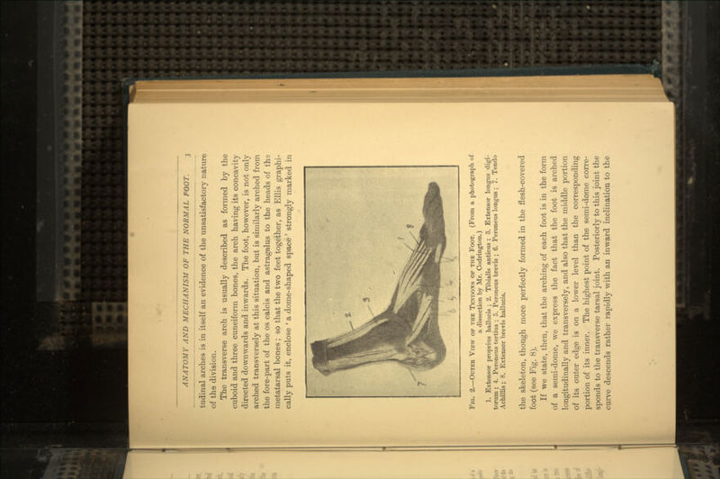 tudinal arches is in itself an evidence of the unsatisfactory nature of the division. The transverse arch is usually described as formed by the cuboid and three cuneiform bones, the arch having its concavity directed downwards and inwards. The foot, however, is not only arched transversely at this situation, but is similarly arched from the fore-part of the os calcis and astragalus to the heads of the metatarsal bones; so that the two feet together, as Ellis graphi- cally puts it, enclose ' a dome-shaped space' strongly marked in Fig. 2.—Outer View op the Tendons of the Foot. (From a photograph of a dissection by Mr. Codrington.) 1. Extensor proprius hallucis ; 2. Tibialis anticus ; 3. Extensor longus digi- torum ; 4. Peroneus tertius ; 5. Peroneus brevis ; 6. Peroneus longus ; 7. Tendo Achillis ; 8. Extensor brevis hallucis. the skeleton, though more perfectly formed in the flesh-covered foot (see Fig. 8). If we state, then, that the arching of each foot is in the form of a semi-dome, we express the fact that the foot is arched longitudinally and transversely, and also that the middle portion of its outer edge is on a lower level than the corresponding portion of its inner. The highest point of the semi-dome corre- sponds to the transverse tarsal joint. Posteriorly to this joint the curve descends rather rapidly with an inward inclination to the