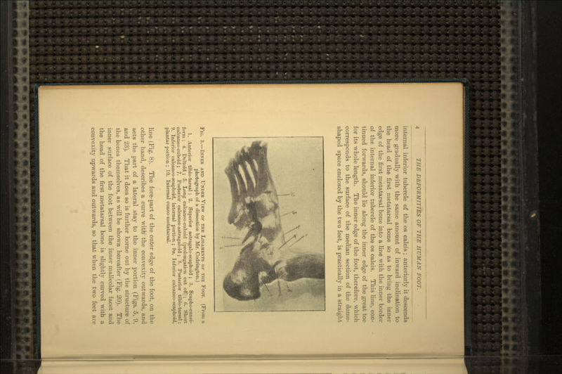 internal inferior tubercle of the os calcis; anteriorly it descends more gradually with the same amount of inward inclination to the head of the first metatarsal bone so as to bring the inner edge of the first metatarsal bone into a line with the inner border of the internal inferior tubercle of the os calcis. This line, con- tinued forwards, should lie along the inner edge of the great toe for its whole length. The inner edge of the foot, therefore, which corresponds to the surface of the median section of the dome- shaped space enclosed by the two feet, is practically in a straight Fig. 3.—Inner and Under View of the Ligaments of the Foot. (From a photograph of a dissection by Mr. Codrington.) 1. Anterior tibio-tarsal ; 2. Superior astragalo-scaphoid; 3. Scapho-cunei- form ; 4. Deltoid ; 5. Long calcaneo-cuboid (prolongation cut off); 6. Short calcaneo-cuboid; 7. Posterior calcaneo-astragaloid ; 8. Posterior tibio-tarsal; 9. Inferior calcaneo-scaphoid, internal portion ; 9a. Inferior calcaneo-scaphoid, plantar portion ; 10. Internal cuneo-metatarsal. line (Fig. 8). The fore-part of the outer edge of the foot, on the other hand, describes a curve with the convexity outwards, and acts the part of a lateral stay to the inner portion (Figs. 5, 9, and 23). That it does so is further borne out by the structure of the bones themselves, as will be shown hereafter (Fig. 20). The inner surface of the foot between the inner malleolar facet and the head of the first metatarsal bone is slightly curved with a convexity upwards and outwards, so that when the two feet are