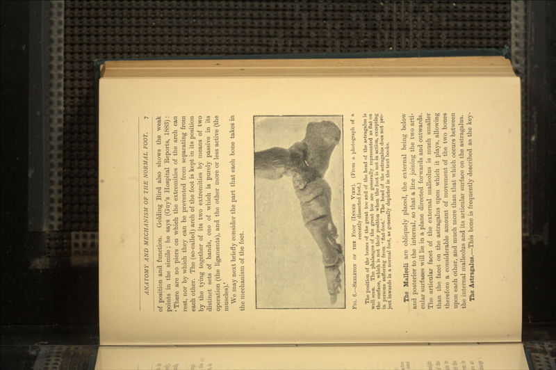 of position and function. Golding Bird also shows the weak points in the simile ; he says (Guy's Hospital Eeports, 1883): ' There are no piers on which the extremities of the arch can rest, nor by which they can be prevented from separating from each other. The (so-called) arch of the foot is kept in its position by the tying together of its two extremities by means of two distinct sets of bands, one of which is purely passive in its operation (the ligaments), and the other more or less active (the muscles).' We may next briefly consider the part that each bone takes in the mechanism of the foot. Fig. 6.—Skeleton ov the Foot (Inner View). (From a photograph of a recently dissected foot.) The position of the bones of the great toe and of the head of the astragalus is well seen. The phalanges of the great toe are generally represented as flat on the surface, which is not their position when the foot is not in action, excepting in persons suffering from ' flat-foot.' The head of the astragalus does not pro- ject inwards in a normal foot, as generally depicted in the text books. The Malleoli are obliquely placed, the external being below and posterior to the internal, so that a line joining the two arti- cular surfaces will lie in a plane directed forwards and outwards. The articular facet of the external malleolus is much smaller than the facet on the astragalus upon which it plays, allowing therefore a considerable amount of movement of the two bones upon each other, and much more than that which occurs between the internal malleolus and its articular surface on the astragalus. The Astragalus.—This bone is frequently described as the key-