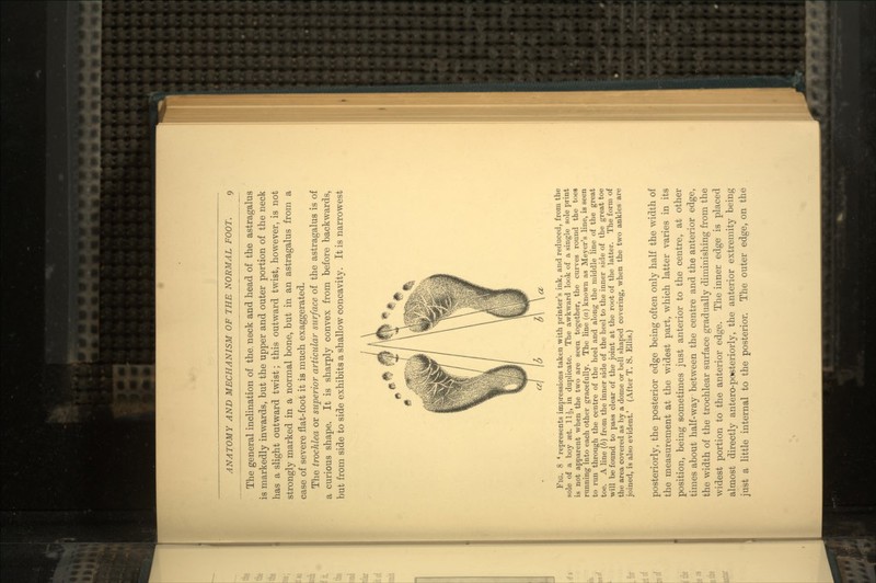 The general inclination of the. neck and head of the astragalus is markedly inwards, but the upper and outer portion of the neck has a slight outward twist; this outward twist, however, is not strongly marked in a normal bone, but in an astragalus from a case of severe flat-foot it is much exaggerated. The trochlea or superior articular surface of the astragalus is of a curious shape. It is sharply convex from before backwards, but from side to side exhibits a shallow concavity. It is narrowest Fig. 8 • represents impressions taken with printer's ink, and reduced, from the sole of a boy set. 11£, in duplicate. The awkward look of a single sole print is not apparent when the two are seen together, the curves round the toes running into each other gracefully. The line (a) known as Meyer's line, is seen to run through the centre of the heel and along the middle line of the great toe. A line (6) from the inner side of the heel to the inner side of the great toe will be found to pass clear of the joint at the root of the latter. The form of the area covered as by a dome or bell shaped covering, when the two ankles are joined, is also evident.' (After T. S. Ellis.) posteriorly, the posterior edge being often only half the width of the measurement at the widest part, which latter varies in its position, being sometimes just anterior to the centre, at other times about half-way between the centre and the anterior edge, the width of the trochlear surface gradually diminishing from the widest portion to the anterior edge. The inner edge is placed almost directly antero-poeteriorly, the anterior extremity being just a little internal to the posterior. The outer edge, on the