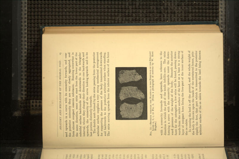 and upwards in a curve with its concavity forwards, and near the posterior extremity they are very closely aggregated, and form almost compact osseous substance. Eunning somewhat in the same direction, some striae start from the lower part of the cuboidal surface backwards and downwards to the triangular interval, where they change their direction to one backwards and upwards, the concavity of the curve looking upwards and in its last portion distinctly forwards. The double arch formed by the striae passing from the posterior articular surface supplies a very strong mechanical arrangement for supporting the pressure of the body transmitted downwards and backwards to the posterior articular surface when standing. The striae curving upwards from the inferior surface of the bone Fig. 12.—Sections through the Scaphoid in the Direction of the Straight Lines a, b, c, in Fig. 5. (From a photograph of sections by W. Kent Hughes.) with a concavity forwards and upwards, have reference to the direction in which the pull of the tendo Achillis acts. The striae forming a curve with the concavity upwards resist the down- ward pressure of the weight of the body. Beneath the anterior facet for the astragalus a few striae will be found, passing down- wards from the under surface of the facet as a base to a strong layer of compact bone lining the fore-part of the inner surface of the os calcis. In running the heel is off the ground, and the whole weight of the body is thrown upon the heads of the metatarsal bones, prin- cipally the first, that part which is transmitted to the posterior articular surface of the os calcis towards the heel being thrown