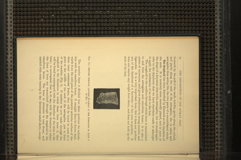 forwards by the pull of the tendo Achillis, partly along the cuboid, and partly along the neck of the astragalus, the os calcis and astragalus thus acting like the two parts of a consolidated whole. The Scaphoid has been described by Hancock as the keystone of the arch. It is certainly more centrally placed, and is more of the shape of a keystone than is the astragalus, but we would again refer to the objections that we have elsewhere made to attempts to apply the mechanism of an arch to the foot. The scaphoid is the medium through which force is transmitted to and from the astragalus and cuneiform bones; it is also a centre of movement, and gives attachment to strong muscles and ligaments. It is a very important bone, but it does not perform any of the functions of a keystone—it has none to perform. It does not receive any weight from above, and does not hold up the arch of the foot. Fig. 13.—Section through another Scaphoid in the Direction of Line b in Fig. 5. The anterior facet is divided into three portions for articula- tion with the cuneiform bones. If straight lines be drawn back- wards from the mid-point of the posterior articular surface of the three inner metatarsal bones, they will be found to meet at a point at the middle of the neck of the astragalus, just in front of the trochlea (Fig. 5). If sections be now made through the scaphoid in the directions in which these lines cross it, they will be found to correspond with the direction of the striae in the bone; to correspond, that is to say, with the direction in which the lines of force are transmitted through the scaphoid to the •cuneiform bones. The bone in structure is very dense, and marked with striae running in the directions noted above, except-