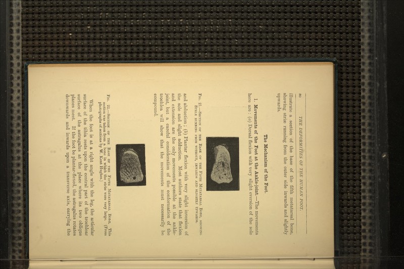 illustrate a section of the base of the fifth metatarsal bone, showing striae running from the outer side inwards and slightly upwards. The Mechanism of the Foot. 1. Movements of the Foot at the Ankle-joint.—The movements here are : (a) Dorsal flexion with very slight eversion of the sole Fig. 21.—Section of the Base of the Fifth Metatarsal Bone, showing Stri.e running from without, inwards and slightly upwards. and abduction ; (b) Plantar flexion with very slight inversion of the sole and slight adduction. Most authors state that flexion and extension are the only movements possible at the ankle- joint, but a careful consideration of the conformation of the trochlea will show that the movements must necessarily be compound. Fig. 22.—Section of the Base of the Fifth Metatarsal Bone. This section was taken from a bone in which the striae were very large. (From photographs of sections by W. Kent Hughes.) When the foot is at a right angle with the leg, the articular surface of the tibia rests upon the central part of the trochlear surface of the astragalus at the place where its two oblique planes meet. If the foot be plantar-flexed, the astragalus rotates downwards and inwards upon a transverse axis, carrying the