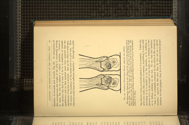 direction downwards and inwards (Fig. 23). In consequence of this arrangement, the weight of the body is continually striving to cause the foot to assume a ' valgus' position. Viewed in the skeleton the foot is seen to be in a condition of unstable equilibrium, and on that account some have asserted that the mechanism of the foot is at fault. But, as Mr. Ellis so truly says, ' Of course, the tendency of the tarsal arch is to give way. How otherwise could there be sufficient elasticity ? Although the yield- Fig. 23.—Vertical Transverse Section through the Ankle. The interosseous ligament is seen filling up the groove in the astragalus and in the os calcis. The two leg bones, the tibia on the inner and the fibula on the outer sides, are also shown with the expanded lower ends cut through. The inclination inwards, showing an apparent disposition to give way, is very manifest. (After T. S. Ellis.) ing element exists, as already stated, it is a necessity. Unless the arch were made, like a piece of masonry, unyielding, it must yield according as it is braced up by the muscles, as in walking, or pressed doivn by the weight of the body, as in standing at ease or in falling suddenly on the feet. To say that this tendency 11 has to be constantly combated by the action of the strong leg muscles, ignores the fact that they do this not as a special exertion for that purpose; they do it in fulfilment of their proper