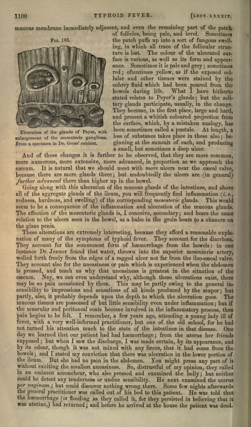 mucous membrane immediately adjacent, and even the remaining part of the patch. of follicles, being pale, and level. Sometimes FIG. 185. the patch puffs up into a sort of fungous swell- ing, in which all trace of the follicular struc- ture is lost. The colour of the ulcerated sur- face is various, as well as its form and appear- ance. Sometimes it is pale and grey ; sometimes red; oftentimes yellow, as if the exposed cel- lular and other tissues were stained by the ochrey fluid which had been poured from the bowels during life. What I have hitherto stated relates to Peyer's glands; but the soli- tary glands participate, usually, in the change. They become, in the first place, large and hard, and present a whitish coloured projection from _^ the surface, which, by a mistaken analogy, has Ulceration of the glands of Peyer, with J>een sometimes called a pustule. At length, a enlargement of the mesenteric ganglions. l°ss of substance takes place in these also j be- From a specimen in Dr. Gross' cabinet ginning at the summit of each, and producing a small, but sometimes a deep ulcer. And of these changes it is further to be observed, that they are more common, more numerous, more extensive, more advanced, in proportion as we approach the caecum. It is natural that we should meet with more ulcers near the caecal valve, because there are more glands there; but undoubtedly the ulcers are (in general) further advanced there than higher up in the bowel. Going along with this ulceration of the mucous glands of the intestines, and above all of the aggregate glands of the ileum, you will frequently find inflammation (i. e., redness, hardness, and swelling) of the corresponding mesenteric glands. This would seem to be a consequence of the inflammation and ulceration of the mucous glands. The affection of the mesenteric glands is, I conceive, secondary; and bears the same relation to the ulcers seen in the bowel, as a bubo in the groin bears to a chancre on the glans penis. These alterations are extremely interesting, because they afford a reasonable expla- nation of many of the symptoms of typhoid fever. They account for the diarrhoea. They account for the commonest form of haemorrhage from the bowels: in one instance Dr. Jenner found that water, thrown into the superior mesenteric artery, welled forth freely from the edges of a ragged ulcer not far from the ileo-csecal valve. They account also for the uneasiness or pain which is experienced when the abdomen is pressed, and teach us why that uneasiness is greatest in the situation of the caecum. Nay, we can even understand why, although these ulcerations exist, there may be no pain occasioned by them. This may be partly owing to the general in- sensibility to impressions and sensations of all kinds produced by the stupor; but partly, also, it probably depends upon the depth to which the ulceration goes. The mucous tissues are possessed of but little sensibility even under inflammation; but if the muscular and peritoneal coats become involved in the inflammatory process, then pain begins to be felt. I remember, a few years ago, attending a young lady ill of fever, with a very well-informed practitioner, but one of the old school, for he had not turned his attention much to the state of the intestines in that disease. One day we learned that our patient had had haemorrhage; from the uterus her friends supposed; but when I saw the discharge, I was made certain, by its appearance, and by its odour, though it was not mixed with any faeces, that it had come from the bowels; and I stated my conviction that there was ulceration in the lower portion of the ileum. But she had no pain in the abdomen. You might press any part of it without exciting the smallest uneasiness. So, distrustful of my opinion, they called in an eminent accoucheur, who also pressed and examined the belly; but neither could he detect any tenderness or undue sensibility. He next examined the uterus per vaginam ; but could discover nothing wrong there. Some few nights afterwards the general practitioner was called out of his bed to this patient. He was told that the haemorrhage (or flooding as they called it, for they persisted in believing that it was uterine,) had returned; and before he arrived at the house the patient was dead.