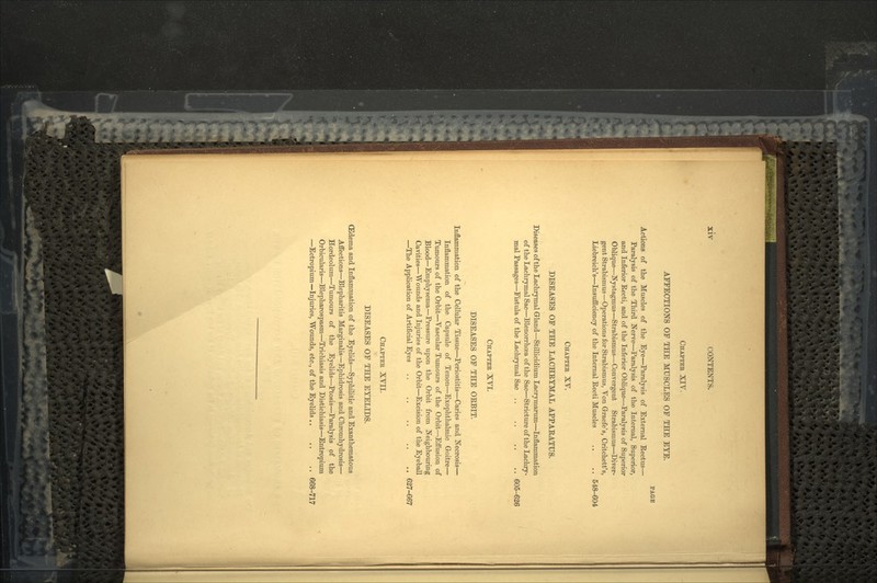 CHAPTEE XIV. AFFECTIONS OF THE MUSCLES OF THE EYE. PA&E Actions of the Muscles of the Eye—Paralysis of External Rectus— Paralysis of the Third Nerve—Paralysis of the Internal, Superior, and Inferior Recti, and of the Inferior Oblique—Paralysis of Superior Oblique—Nystagmus—Strabismus—Convergent Strabismus—Diver- gent Strabismus—Operations for Strabismus, Von Graefe's, Critchett's, Liebreich's—Insufficiency of the Internal Recti Muscles ,. .. 548-604 CHAPTEB XV. DISEASES OF THE LACHRYMAL APPARATUS. Diseases of the Lachrymal Gland—Stillicidium Lacrymarum—Inflammation of the Lachrymal Sac—Blenorrhoea of the Sac—Stricture of the Lachry- mal Passages—Fistula of the Lachrymal Sac .. .. .. .. 605-626 CHAPTEE XVI. DISEASES OF THE ORBIT. Inflammation of the Cellular Tissue—Periostitis—Caries and Necrosis— Inflammation of the Capsule of Tenon—Exophthalmic Goitre— Tumours of the Orbit—Vascular Tumours of the Orbit—Effusion of Blood—Emphysema—Pressure upon the Orbit from Neighbouring Cavities—Wounds and Injuries of the Orbit—Excision of the Eyeball —The Application of Artificial Eyes 627-667 CHAPTEE XVII. DISEASES OF THE EYELIDS. (Edema and Inflammation of the Eyelids—Syphilitic and Exanthematous Affections—Blepharitis Marginalis—Ephidrosis and Chromhydrosis— Hordeolum—Tumours of the Eyelids—Ptosis—Paralysis of the Orbicularis—Blepharospasm—Trichiasis and Distichiasis—Entropium —Ectropium—Injuries, Wounds, etc., of the Eyelids .. .. .. 668-717