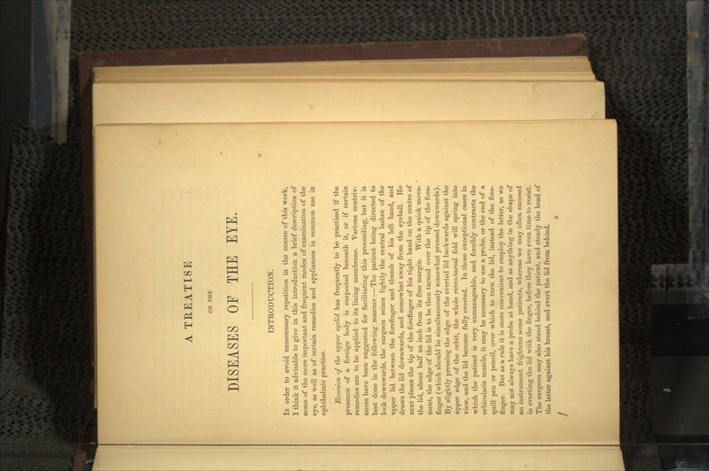 A TREATISE ON THE DISEASES OP THE EYE. INTRODUCTION. IN order to avoid unnecessary repetition in the course of this work, I think it advisable to give in this introduction a brief description of some of the more important and frequent modes of examination of the eye, as well as of certain remedies and appliances in common use in ophthalmic practice. Eversion of the upper eyelid has frequently to be practised if the presence of a foreign body is suspected beneath it, or if certain remedies are to be applied to its lining membrane. Various contriv- ances have been suggested for facilitating this proceeding, but it is best done in the following manner:—The patient being directed to look downwards, the surgeon seizes lightly the central lashes of the upper lid between the forefinger and thumb of his left hand, and draws the lid downwards, and somewhat away from the eyeball. He next places the tip of the forefinger of his right hand on the centre of the lid, about half an inch from its free margin, With a quick move- ment, the edge of the lid is to be then turned over the tip of the fore- finger (which should be simultaneously somewhat pressed downwards). By slightly pressing the edge of the everted lid backwards against the upper edge of the orbit, the whole retro-tarsal fold will spring into view, and the lid become fully everted. In those exceptional cases in which the patient is very unmanageable, and forcibly contracts the orbicularis muscle, it may be necessary to use a probe, or the end of a quill pen or pencil, over which to turn the lid, instead of the fore- finger. But as a rule it is more convenient to employ the latter, as we may not always have a probe at hand, and as anything in the shape of an instrument frightens some patients, whereas we may often succeed in everting the lid with the finger, before they have even time to resist. The surgeon may also stand behind the patient, and steady the head of the latter against his breast, and evert the lid from behind.