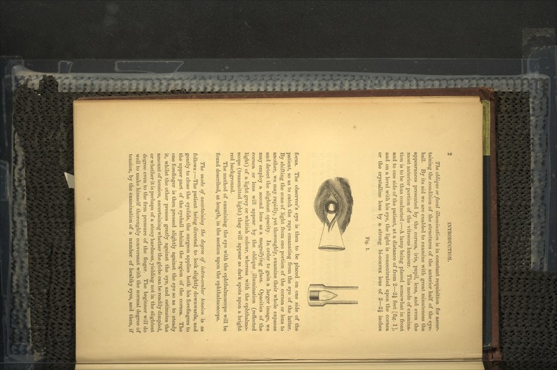 The oblique or focal illumination is in constant requisition for ascer- taining the condition of the structures of the anterior half of the eye- ball. By its aid we are enabled to examine with great minuteness the appearances presented by the cornea, iris, pupil, lens, and even the most anterior portion of the vitreous humour. This mode of examina- tion is to be thus conducted:—A lamp being placed somewhat in front and to one side of the patient, at a distance of from 2—2£ feet [fig. 1], and on a level with his eye, the light is concentrated upon the cornea or the crystalline lens by a strong bi-con vex lens of 2—2j inches Fig. 1. focus. The observer's eye is then to be placed on one side of the patient, so as to catch the rays emanating from the eye of the latter. By shifting the cone of light from one portion of the cornea or lens to another, we may rapidly, yet thoroughly, examine their whole expanse and detect the slightest opacity. In order to gain a larger image, we may employ a second lens as a magnifying glass. Opacities of the cornea or lens will appear by the oblique illumination (reflected light) of a light grey or whitish colour, whereas with the ophthalmo- scope (transmitted light) they will appear as dark spots upon a bright red background. The method of examining the eye with the ophthalmoscope will be found described, at length, in the section upon the ophthalmoscope. The mode of ascertaining the degree of intra-ocular tension is as follows :—The patient being directed to look slightly downwards, and gently to close the eyelids, the surgeon applies both his forefingers to the upper part of the eyeball behind the region of the cornea. The one forefinger is then pressed slightly against the eye so as to steady it, whilst the other presses gently against the eye, and estimates the amount of tension, ascertaining whether the globe can be readily dimpled, or whether it is perhaps of a stony hardness, yielding not in the slightest degree even to the firm pressure of the finger. The beginner will do well to make himself thoroughly conversant with the normal degree of tension, by the examination of a number of healthy eyes, and then, if