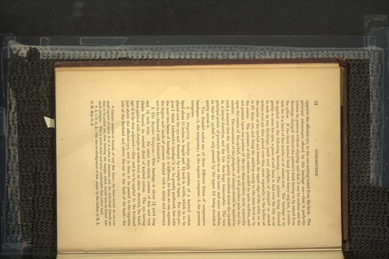 opposite the affected eye, to the one coming round from the back. The principal advantages offered by this bandage are—that it perfectly retains its position without slipping, and that it can be undone and the dressings changed without the patient's head having to be raised from the pillow. If the thick knitted band proves heavy and hot, I substi- tute for it a band of fine muslin or of elastic web. The bandage is to be applied over the following dressing:—The patient being directed gently to close his eyes, a piece of soft linen is laid over the lids so as to soak up any discharge, small oval pledgets of charpie* or carded cotton-wool are then placed over this, more especially in the hollow at the inside of the eyeball and beneath the upper edge of the orbit, so as to fill these out, and bring the padding nearly to the same level as in the centre. The pressure of this cushion should be quite uniform, and not greater upon one portion of the eye than another, more especially upon the centre of the eyeball, otherwise it will produce pain and dis- comfort. The succession of the pledgets of charpie should be applied in such a manner that the upper lid is gently stretched across the eyeball in a lateral direction, and the lids thus kept immoveable. The two principal points of pressure should be at the inner and outer canthus, so that the eyeball is only pressed by the upper lid being stretched gently across it. Von Grraefef makes use of three different forms of compressive bandages—1, the temporary; 2, the regular compress; 3, the pressure compress. 1. The temporary bandage simply consists of a knitted cotton band about 15 inches in length and 1|- inch in width, which is to be placed over the eye and fastened by a couple of tapes. For this pur- pose I think Liebreich's bandage is to be greatly preferred, but with the next two forms of bandage it is different, for here we can regulate the degree and mode of pressure desired with a nicety and accuracy not to be obtained with Liebreich's. 2. The Regular Compress.—This bandage is about If yard long and 1£ inch wide. Its outer two-thirds consist of fine and very elastic flannel, its central third of knitted cotton. The eye having been padded with charpie or cotton wool, as above directed, the band- age is to be thus adjusted:—One end is to be applied to the forehead just above the affected eye, and is then to be passed to the opposite side of the forehead and above the ear to the back of the head; the * Charpie consists of threads of very fine linen; the linen should be cut into small squares of about 3 or 4 inches in diameter, and the individual threads are then to be pulled out, thus forming the charpie, which should then be folded into small pledgets. This is much cooler and more comfortable than cotton wool. t A. f. O. ix, 2; vide also an abridgement of this paper, by the author, in E. L. O. H. Eep. iv, 2.