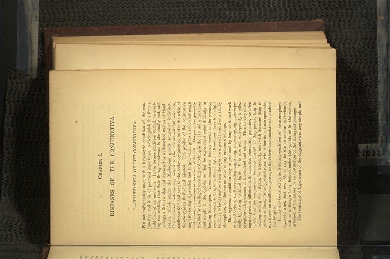 CHAPTER I. DISEASES OF THE CONJUNCTIVA. 1.—HYPEILEMIA OF THE CONJUNCTIVA. WE not unfreqnently meet with a hypersemic condition of the con- junctiva, and it is of practical importance to distinguish this from a mild form of conjunctivitis. In the former condition we find, on evert- ing the eyelids, that their lining membrane is abnormally red, and perhaps a little swollen, and traversed by well-marked meshes of blood- vessels, which render the Meibomian glands somewhat indistinct. This increased redness may extend to the retro-tarsal fold, caruncle, semiltmar fold, and even to the ocular conjunctiva, so that the white of the eye appears flushed and injected. The papillae of the conjunctiva may also be slightly swollen and turgid, which gives a somewhat rough and velvety appearance to the inside of the lids. The patient is generally troubled by a feeling of smarting and itching in the eye, and a heaviness and weight in the eyelids, so that he experiences some difficulty in keeping them open. These sensations become worse in the evening, more especially in bright artificial light. Sometimes there is a slight tendency to lachrymation when the eyes are exposed to wind or a smoky atmosphere, but there is no trace of any mucous discharge. This hyperaemic condition may be produced by long-continued work at small objects, such as reading, engraving, microscopizing, more espe- cially by strong artificial light. It is also not unfrequently a reflex symptom of hyperaamia of the choroid and retina. Thus in very short- sighted persons affected with sclerotico-choroiditis posterior, we often notice that the conjunctiva becomes flushed if they persist long in reading, sewing, etc. Again, we frequently meet with the same thing in persons suffering from hypermetropia, who either do not use spectacles at all, or of an insufficient power, so that their accommodation is strained and fatigued. It may also be caused by an irritating condition of the atmosphere, e.g., cold wind, dust, etc. Or it may be due to mechanical irritants, such as a foreign body lodged under the eyelids or in the cornea, inversion of the lashes, or an obstruction of the lachrymal passages. The treatment of hypersemia of the conjunctiva is very simple, and