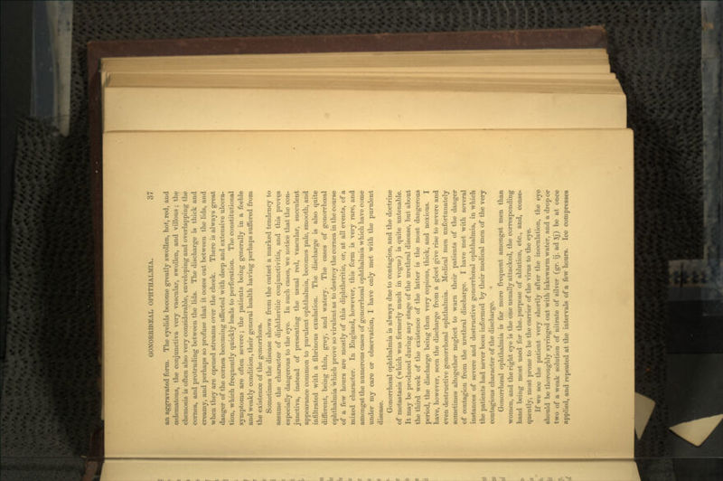 an aggravated form. The eyelids become greatly swollen, hot, red, and oedematous, the conjunctiva very vascular, swollen, and villous ; the chemosis is often also very considerable, enveloping and overlapping the cornea, and protruding between the lids. The discharge is thick and creamy, and perhaps so profuse that it oozes out between the lids, and when they are opened streams over the cheek. There is always great danger of the cornea becoming affected with deep and extensive ulcera- tion, which frequently quickly leads to perforation. The constitutional symptoms are often severe; the patients being generally in a feeble and weakly condition, their general health having perhaps suffered from the existence of the gonorrhoea. Sometimes the disease shows from the outset a marked tendency to assume the character of diphtheritic conjunctivitis, and this proves especially dangerous to the eye. In such cases, we notice that the con- junctiva, instead of presenting the usual red, vascular, succulent appearance common to purulent ophthalmia, becomes pale, smooth, and infiltrated with a fibrinous exudation. The discharge is also quite different, being thin, grey, and watery. The cases of gonorrhceal ophthalmia which prove so virulent as to destroy the cornea in the course of a few hours are mostly of this diphtheritic, or, at all events, of a mixed character. In England, however, this form is very rare, and amongst the numerous cases of gonorrhceal ophthalmia which have come under my care or observation, I have only met with the purulent disease. Gonorrhceal ophthalmia is always due to contagion, and the doctrine of metastasis (which was formerly much in vogue) is quite untenable. It may be produced during any stage of the urethral disease, but about the third week of the existence of the latter is the most dangerous period, the discharge being then very copious, thick, and noxious. I have, however, seen the discharge from a gleet give rise to severe and even destructive gonorrhceal ophthalmia. Medical men unfortunately sometimes altogether neglect to warn their patients of the danger of contagion from the urethral discharge. I have met with several instances of severe and destructive gcnorrhceal ophthalmia, in which the patients had never been informed by their medical men of the very contagious character of the discharge. Gonorrhceal ophthalmia is far more frequent amongst men than women, and the right eye is the one usually attacked, the corresponding hand being most used for the. purpose of ablution, etc., and, conse- quently, most prone to be the carrier of the virus to the eye. If we see the patient very shortly after the inoculation, the eye should be thoroughly syringed out with lukewarm water, and a drop or two of a weak solution of nitrate of silver (gr. ij. ad 3j) be at once applied, and repeated at the intervals of a few hours. Ice compresses