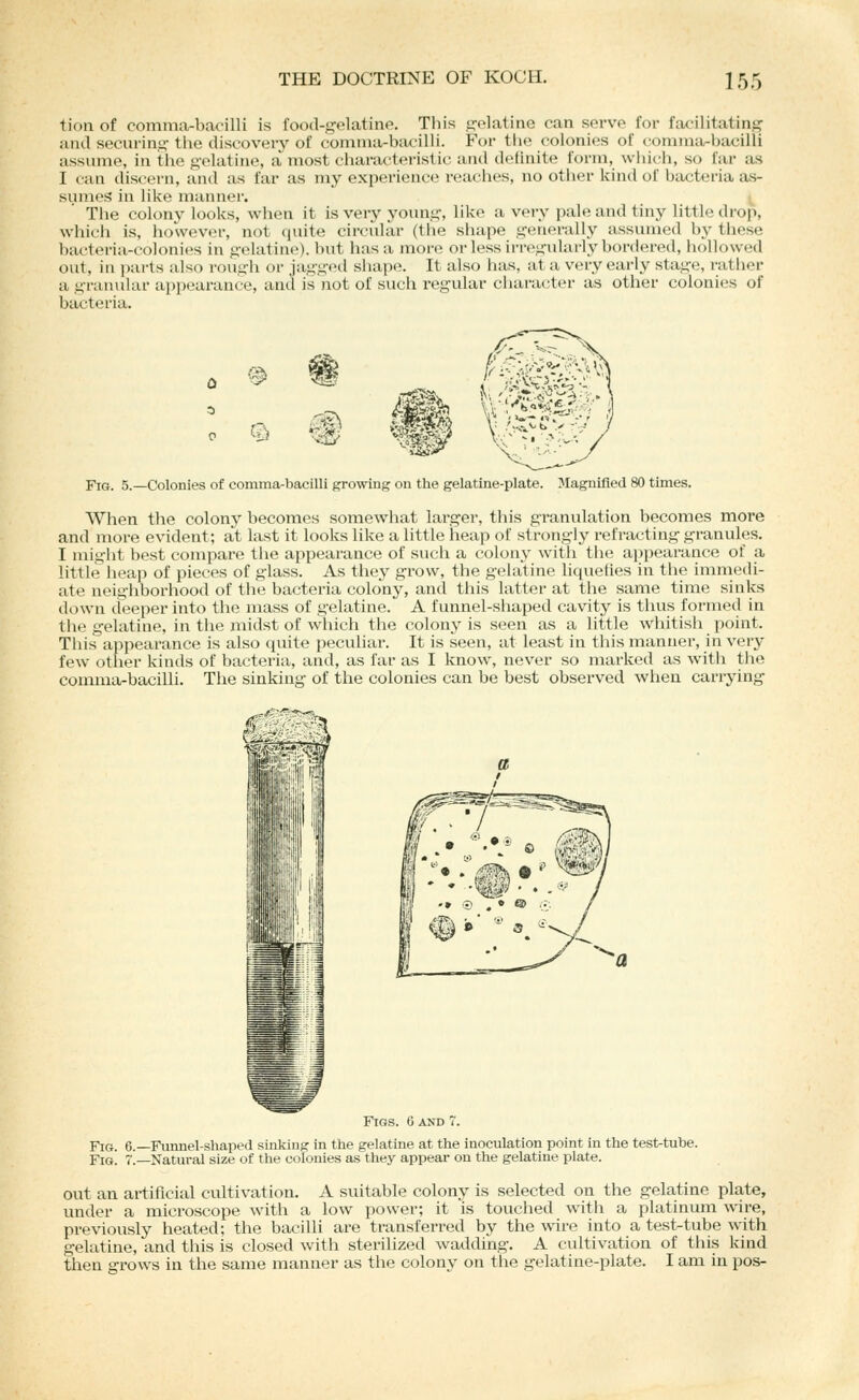 ■tion of comma-bacilli is food-gelatine. This gelatine can serve for facilitating aiul securing tlie discovery of comma-bacilli. For th(^ colonies of comma-bacilli assume, in the gelatine, a'^most characteristic and definite form, which, so far as I can discern, and as far as my exi)ei'ieiice reaches, no otiier kind of bacteria as- sumes in like mannei-. The colony looks, when it is very young, like a very pale and tiny little drop, which is, however, not quite circidar (the shape genei-ally assumed by these bacteria-colonies in gelatine), but has a more or less irregularly bordered, hollowed out, in parts also rough or jagged shape. It also has, at a very early stage, rather a granular appearance, and is not of such regular character as other colonies of bacteria. 0 C^ Fig. 5.—Colonies of comma-bacilli growing on the gelatine-plate. Magnified 80 times. When the colony becomes somewhat larger, this granulation becomes more and more evident; at last it looks like a little heap of strongly refracting granules. I might best compare the appearance of such a colony with the appearance of a little heap of pieces of glass. As they grow, the gelatine liquelies in the immedi- ate neighborhood of the bacteria colony, and this latter at the same time sinks down deeper into the mass of gelatine. A funnel-shaped cavity is thus formed in the gelatine, in the midst of which the colony is seen as a little whitish point. This appearance is also qvnte peculiar. It is seen, at least in this manner, in very few other kinds of bacteria, and, as far as I know, never so marked as with the comma-bacilli. The sinking of the colonies can be best observed when carrying Figs. 0 and 7. Fig. 6.—Funnel-shaped sinking in the gelatine at the inoculation point in the test-tube. Fig. 7.—Natural size of the colonies as they appear on the gelatine plate. out an artificial cultivation. A suitable colony is selected on the gelatine plate, under a microscope with a low power; it is touched with a platinum wire, previously heated; the bacilli are transferred by the wire into a test-tube with gelatine, and this is closed with sterilized wadding. A cultivation of this kind then grows in the same manner as the colony on the gelatine-plate. I am in pos-