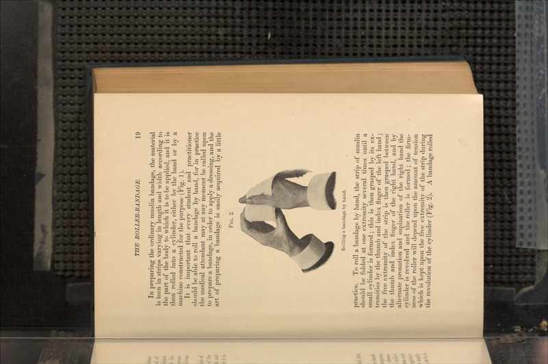 In preparing the ordinary muslin bandage, the material is torn in strips varying in length and width according to the part of the body to which it is to be applied, and it is then rolled into a cylinder, either by the hand or by a machine constructed for the purpose (Fig. 1). It is important that every student and practitioner should be able to roll a bandage by hand, for in practice the medical attendant may at any moment be called upon to prepare a bandage, in order to apply a dressing, and the art of preparing a bandage is easily acquired by a little FIG. 2. Rolling a bandage by hand. practice. To roll a bandage by hand, the strip of muslin should be folded at one extremity several times until a small cylinder is formed; this is then grasped by its ex- tremities by the thumb and index finger of the left hand; the free extremity of the strip is then grasped between the thumb and index finger of the right hand, and by alternate pronation and supination of the right hand the cylinder is revolved and the roller is formed ; the firm- ness of the roller will depend upon the amount of tension which is kept upon the free extremity of the strip during the revolution of the cylinder (Fig. 2). A bandage rolled