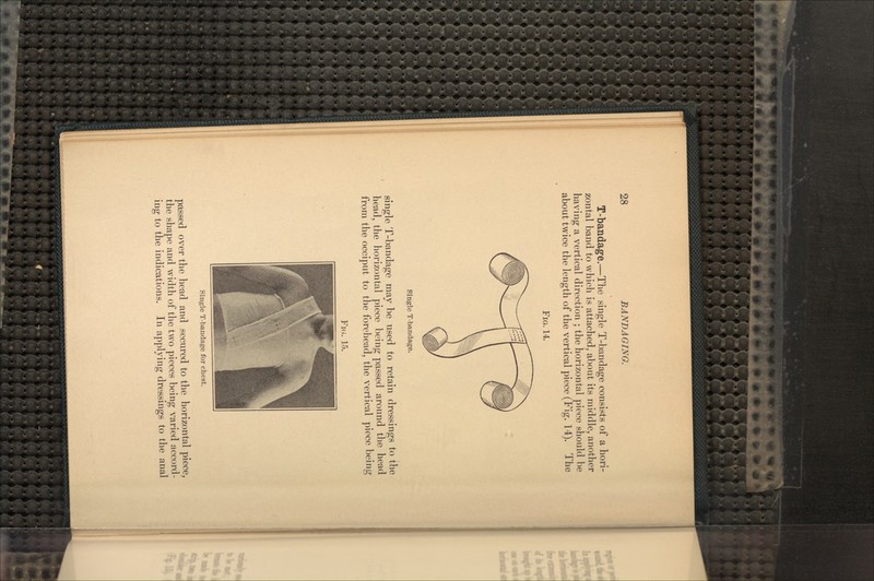 T-bandage.—The single T-bandage consists of a hori- zontal band to whieh is attached, about its middle, another having a vertical direction ; the horizontal piece should be about twice the length of the vertical piece (Fig. 14). The FIG. 14. Single T-bandage. single T-bandage may be used to retain dressings to the head, the horizontal piece being passed around the head from the occiput to the forehead, the vertical piece being FIG. 15. Single T-bandage for chest. passed over the head and secured to the horizontal piece, the shape and width of the two pieces being varied accord- ing to the indications. In applying dressings to the anal