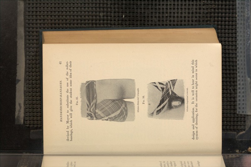 devised by Mayor to substitute the use of the roller- bandage, which will give the student some idea of their FIG. 35. Gluteo-femornl triangle. Gluteo-inguiiml cravat. design and application. It is well to bear in mind this system of dressing, for the occasion might occur in which