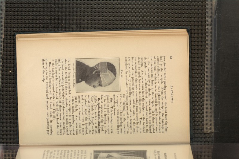 FIG. 51. two circular turns passing around the head from the fore- head to the occiput. From the occiput the bandage is carried obliquely over the highest part of the lateral aspect of the head, which is to be covered in, and is passed over the forehead and back to the occiput. It is then carried to the forehead by a circular turn, which is conducted obliquely over the other side of the head and back to the occiput. A circular turn from the occiput to the forehead should be made between the oblique turns. These turns are repeated, so that each succeeding turn covers in three- fourths of the preceding turn until the sides of the head are covered in by descending turns, and the bandage is completed by a circular turn passing around the head from the forehead to the occiput (Fig. 50). This bandage may be applied with descending or ascending turns. Use.—This bandage is em- ployed to make pressure upon or to hold a dressing to the lateral aspects of the head. Occipito-frontal Bandage. Roller Two Inches' in Width, Four Yards in Length.—The initial extremity of the roller is placed upon the forehead, and a circular turn is made around the forehead and occi- put to fix it. A circular turn is then made, passing around the head from a point below the occiput to a point just above the forehead ; the next circular turn is made around the head ascending posteriorly and descending anteriorly, and after a sufficient number of these turns have been made to cover in the front and back of the head the end of the bandage is secured with a pin (Fig. 51). Use.—This bandage will be found useful in securing dressings to the forehead and anterior and posterior por- tions of the scalp. Occipito-frontal bandage.