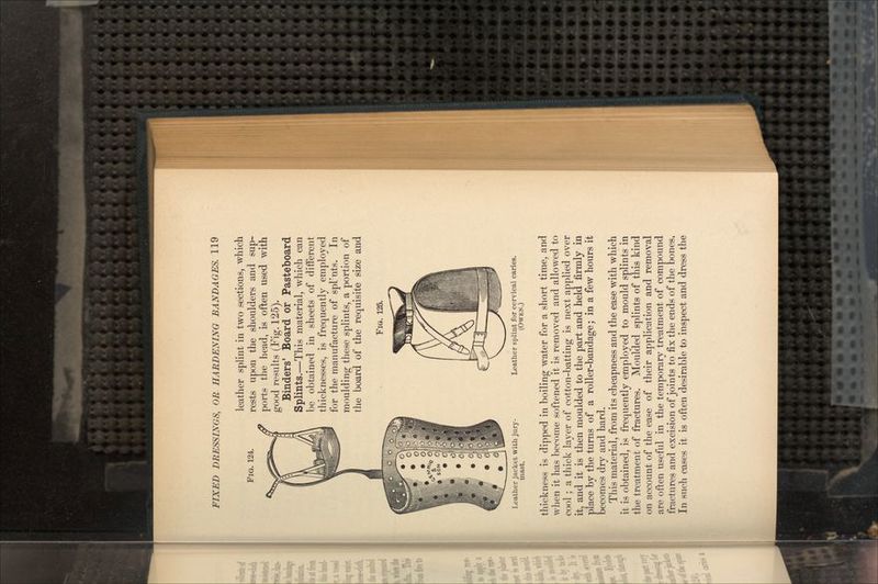 FIG. 124. Leather jacket, with jury- mast. leather splint in two sections, which rests upon the shoulders and sup- ports the head, is often used with good results (Fig. 125). Binders' Board or Pasteboard Splints.—This material, which can be obtained in sheets of different thicknesses, is frequently employed for the manufacture of spl'nts. In moulding these splints, a portion of the board of the requisite size and FIG. 125. Leather splint for cervical caries. (OWEN.) thickness is dipped in boiling water for a short time, and when it has become softened it is removed and allowed to cool; a thick layer of cotton-batting is next applied over it, and it is then moulded to the part and held firmly in place by the turns of a roller-bandage; in a few hours it becomes dry and hard. This material, from its cheapness and the ease with which it is obtained, is frequently employed to mould splints in the treatment of fractures. Moulded splints of this kind on account of the ease of their application and removal are often useful in the temporary treatment of compound fractures and excision of joints to fix the ends of the bones. In such cases it is often desirable to inspect and dress the