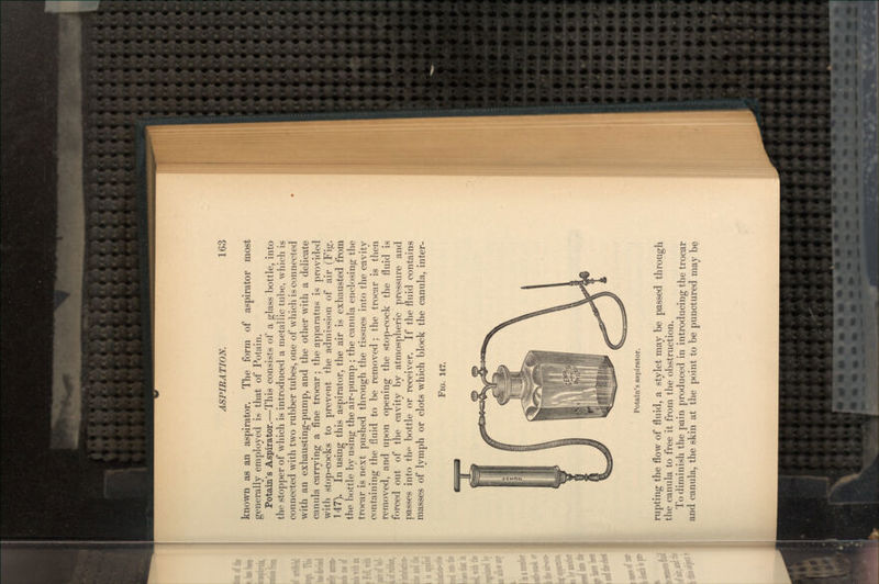 known as an aspirator. The form of aspirator most generally employed is that of Potain. Potain's Aspirator.—This consists of a glass bottle, into the stopper of which is introduced a metallic tube, which is connected with two rubber tubes, one of which is connected with an exhausting-pump, and the other with a delicate canula carrying a fine trocar; the apparatus is provided with stop-cocks to prevent the admission of air (Fig. 147). In using this aspirator, the air is exhausted from the bottle by using the air-pump ; the canula enclosing the trocar is next pushed through the tissues into the cavity containing the fluid to be removed ; the trocar is then removed, and upon opening the stop-cock the fluid is forced out of the cavity by atmospheric pressure and passes into th*1 bottle or receiver. If the fluid contains masses of lymph or clots which block the canula, inter- FIG. 147. Potain's aspirator. rupting the flow of fluid, a stylet may be passed through the canula to free it from the obstruction. To diminish the pain produced in introducing the trocar and canula, the skin at the point to be punctured may be