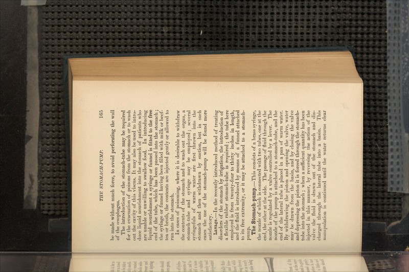 he made without much force, to avoid perforating the wall of the oesophagus. The introduction of the stomach-tube may be required for the evacuation of poisons from the stomach or to wash out the cavity of this viscus. It may also be used to intro- duce liquid nourishment into the stomach of patients who are unable or unwilling to swallow food. In introducing liquid nourishment a syringe or funnel is fitted to the free end of the tube, which has been passed into the stomach; the syringe or funnel having been filled with milk or beef- tea or broth, the contents are injected gently or allowed to run into the stomach. In cases of poisoning, where it is desirable to withdraw the contents of the stomach and to wash out the organ, a stomach-tube and syringe may be employed; several syringefuls of warm water are first thrown into the stomach and then withdrawn by suction, but in such cases the use of the stomach-pump will be found more satisfactory. Lavage.—In the recently introduced method of treating disorders of the stomach by irrigation, the introduction of a flexible rubber stomach-tube is required; the tube here employed is from twenty-four to thirty inches in length, and the fluid is introduced by means of a funnel attached to its free extremity, or it may be attached to a stomach- pump. The Stomach-pump.—This consists of a brass syringe, the nozzle of which is connected with two tubes, one at the end, the other at the side. The passage of fluid through the nozzle is regulated by a valve controlled by a lever. The nozzle of the pump is attached to a stomach-tube, and the end of the lateral tube is placed in a pan of warm water. By withdrawing the piston and opening the valve, water may be drawn from the basin, and by closing the valve and depressing the piston it is forced through the stomach- tube into the stomach ; when a sufficient quantity has been injected in this manner, by reversing the action of the valve the fluid is drawn out of the stomach and dis- charged through the lateral tube into a basin. This manipulation is continued until the water returns clear