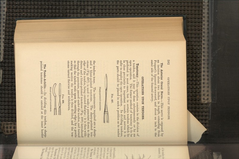 The Anterior Crural Nerve.—This nerve is exposed by an incision about two inches in length, extending from Poupart's ligament downward, and about an inch to the outer side of the femoral artery. OPERATIONS UPON TENDONS. Tenotomy.—This operation consists in the division of a tendon, and it may be done subcutaneously or by an open operation. The former method of tenotomy is to be preferred in most cases, but in certain tendons which lie in close proximity to important vessels and nerves it is safer to employ the open operation. In dividing tendons, the parts should be placed in such a position as to render FIG. 487. Sharp-pointed tenotome. the tendons tense. The instruments required are a sharp- and a blunt-pointed tenotome. The sharp-pointed ten- otome (Fig. 487) is used to make a puncture down to the edge of the tendon, being entered flatwise; it is then with- drawn and a blunt-pointed tenotome (Fig. 488) introduced through the puncture, passed under the tendon, and turned so that the tendon rests upon its cutting edge; by a gentle rocking motion the tendon is then divided, and the ten- otome turned flatwise and withdrawn. FIG. 488. Blunt-pointed tenotomes. The Tendo-Achillis.—In dividing this tendon, a sharp- pointed tenotome should be entered at the inner border