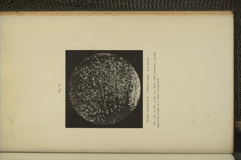 ■*H •...'« Normal Adrenal body. Polarised light. Low power. The cells of the cortex are filled with numerous crystals appearing bright on a dark background.