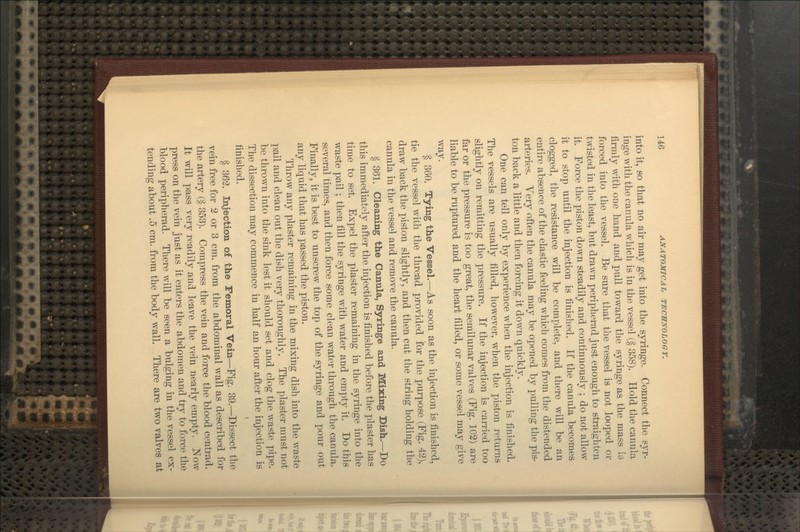 into it, so that no air may get into tlie syringe. Connect the syr- inge with the caniila which is in the vessel (§ 358). Hold the canula firmly with one hand and pull toward the syringe as the mass is forced into the vessel. Be sure that the vessel is not looped or twisted in the least, but drawn peripherad just enough to straighten it. Force the piston down steadily and continuously ; do not allow it to stop until the injection is finished. If the canula becomes clogged, the resistance will be complete, and there will be an entire absence of the elastic feeling which comes from the distended arteries. Very often the canula may be opened by pulling the pis- ton back a little and then forcing it down quickly. One can tell only by experience when the injection is finished. The vessels are usually filled, however, when the piston returns slightly on remitting the pressure. If the injection is carried too far or the pressure is too great, the semilunar valves (Fig. 102) are liable to be ruptured and the heart filled, or some vessel may give way. § 360. Tying the Vessel.—As soon as the injection is finished, tie the vessel with the thread provided for the purpose (Fig. 42), draw back the joiston slightly, and then cut the string holding the canula in the vessel and remove the canula. § 361. Cleaning the Canula, Syringe and Mixing Dish.—Do this immediately after the injection is finished before the plaster has time to set. Expel the plaster remaining in the syringe into the waste pail; then fill the syringe with water and empty it. Do this several times, and then force some clean water through the canula. Finally, it is best to unscrew the top of the syringe and i)our out any liquid that has passed the piston. Throw any plaster remaining in the mixing dish into the waste pail and clean out the dish very thoroughly. The plaster must not be thrown into the sink lest it should set and clog the waste pipe. The dissection may commence in half an hour after the injection is finished. ' § 362. Injection of the Femoral Vein—Fig. 39.—Dissect the vein free for 2 or 3 cm. from the abdominal wall as described for the artery (§ 353). Compress the vein and force the blood centrad. It will pass N%Yj readily and leave the vein nearly empty. Now press on the vein just as it enters the abdomen and try to force the blood peripherad. There will be seen a bulging in the vessel ex- tending about .5 cm. from the body wall. There are two valves at