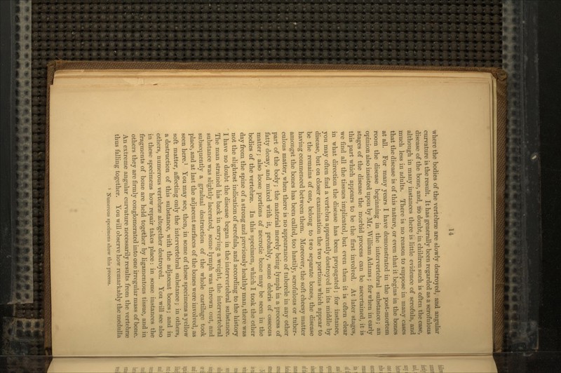 where the bodies of the vertebrae are slowly destroyed, and angular curvature is the result. It has generally been regarded as a scrofulous disease of the bone, and, no doubt, in children such is often the case, although in many instances there is little evidence of scrofula, and much less in adults. There is no reason to suppose in many cases that the disease is of this nature, or even that it begins in the bones at all. For many years I have demonstrated in the post-mortem room the disease beginning in the intervertebral substance; an opinion also insisted upon by Mr. William Adams; for when in early stages of the disease the morbid process can be ascertained, it is this part which appears to be the first involved. At later stages, we find all the tissues implicated, but even then it is often clear in what direction the disease has been propagated; for instance, you may often find a vertebra apparently destroyed in its middle by disease, but on closer examination the two portions which appear to be the remains of one, belong to two separate bones, the disease having commenced between them. Moreover, the soft cheesy matter amongst the bones has been called, too hastily, scrofulous or tuber- culous matter, when there is no appearance of tubercle in any other part of the body; the material merely being lymph in a process of fatty decay, and mixed with it, probably, some debris of osseous matter; also loose portions of necrotic bone may be seen in the bodies of the vertebrae. In this specimen, which I took the other day from the spine of a strong and previously healthy man, there was not the slightest indication of scrofula, and according to the history I have no doubt the disease began in the intervertebral substance. The man strained his back in carrying a weight, the intervertebral substance was slightly lacerated, some lymph was thrown out, and subsequently a gradual destruction of the whole cartilage took place, and at last the adjacent surfaces of the bones were involved, as seen here.1 You may see, then, in some of these specimens a yellow soft matter, affecting only the intervertebral substance; in others, a destruction of this substance, with the adjacent bones; and in others, numerous vertebrae altogether destroyed. You will see also in these specimens how repair takes place: in some instances the fragments of bone are held together by ligamentous tissue, and in others they are firmly conglomerated into one irregular mass of bone. An extreme angular curvature necessarily results from the vertebne thus falling together. You will observe how remarkably the medulla 1 Numerous specimens show this process.