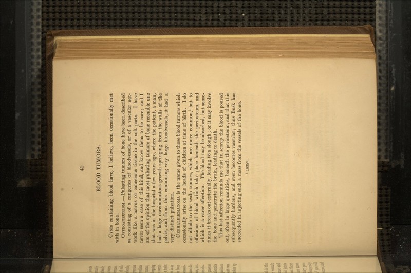 BLOOD TUMORS. CYSTS containing blood have, I believe, been occasionally met with in bone. OSTEOANEURISM.—Pulsating tumors of bone have been described as consisting of a congeries of bloodvessels, or of a vascular net- work like a nsevus or cancerous tissue in the soft parts. I have never seen a case of this kind, and know them to be rare; and I am of the opinion that most pulsating tumors of bone resemble one that was in the hospital a few years ago, where the patient, a man, had a large carcinomatous growth springing from the walls of the pelvis, and from this containing very large bloodvessels, it had a very distinct pulsation. CEPHALH^MATOMA is the name given to those blood tumors which occasionally arise on the heads of children at time of birth. I do not allude to the scalp tumors, which are more common,1 but to effusions of blood which take place beneath the periosteum, and which is a rarer affection. The blood may be absorbed, but some- times it breaks out externally, leading to a slough; or it may involve the bone and penetrate the brain, leading to death. This last affection reminds me that in scurvy the blood is poured out, often in large quantities, beneath the periosteum, and that this subsequently hardens, and even becomes vascular; thus Busk has succeeded in injecting such a mass from the vessels of the bone. 1 163545.