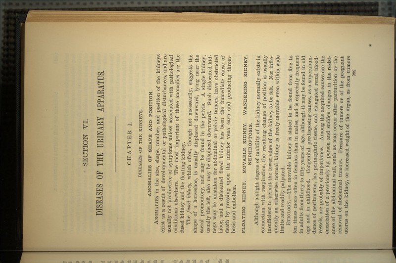 SECTION VI. DISEASES OF THE URINARY APPARATUS. CHAPTEE I. DISEASES OF THE KIDNEYS. ANOMALIES OF SHAPE AND POSITION. ANOMALIES in the size, shape, number, and position of the kidneys exist as a result of developmental or pathological disturbances, and are usually not productive of symptoms unless associated with pathological conditions elsewhere. The most important of these anomalies are the fused kidney and the floating kidney. The fused kidney, which often, though not necessarily, suggests the shape of a horseshoe, is usually displaced downward, lying near the sacral promontory, and may be found in the pelvis. A single kidney, usually the left, also may be displaced downward. Such dislocated kid- neys may be mistaken for abdominal or pelvic tumors, have obstructed labor, and a dislocated fused kidney has been the immediate cause of death by pressing upon the inferior vena cava and producing throm- bosis and embolism. FLOATING KIDNEY. MOVABLE KIDNEY. WANDERING KIDNEY. NEPHROPTOSIS. Although a slight degree of mobility of the kidney normally exists in connection with respiration, the resulting change of position is usually insufficient to permit the lower edge of the kidney to be felt. Not infre- quently an otherwise normal kidney is freely movable even within wide limits and readily palpated. ETIOLOGY.—The movable kidney is stated to be found from five to ten times more often in females than in males, and is especially frequent in adults from thirty to fifty years of age, although it may be found in old age and in childhood. Congenital predisposing causes, as a superabun- dance of peritoneum, lax perinephric tissue, and elongated renal blood- vessels, are probably of importance. Among the acquired causes are the emaciation of a previously fat person and sudden changes in the resist- ance of the abdominal wall, such as may occur after parturition or the removal of abdominal tumors. Pressure of tumors or of the pregnant uterus on the kidney, or increased weight of the organ, as from tumors