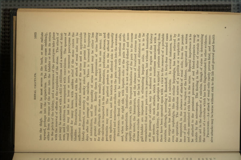 into the thigh. It may be most severe in the back, or may radiate upward, perhaps into the epigastrium. The pain may cease suddenly, either from the escape of the stone into the bladder or from its return to the pelvis of the kidney, and a recurrence of the paroxysm take place with the renewal of efforts at the expulsion of the stone. The attack of pain may be associated with a chill or chilliness and a sensation of faint- ness, and in children be accompanied with convulsions. The spasms of renal colic may last for an hour or more, or recurrent paroxysms be continued for many hours, with sudden relief if the stone enters the bladder. Haematuria associated with the attack of renal colic may be sufficient to produce a distinct redness of the urine and an appreciable bloody sediment, or merely a smoky color, and may persist for several days after the passage of the calculus. There is increased frequency of micturition, and the quantity of urine passed may be either less or greater than normal. Earely there is suppression of urine lasting for days, although the stone is usually impacted in but one ureter. If the calculus is impacted in the ureter, ulceration, perforation, abscess, and peritonitis may occur. The patient prefers to lie on the affected side with updrawn knees, and the testicle on the affected side is frequently retracted and sometimes swollen when the pain extends into the scrotum. DIAGNOSIS.—Renal colic may be confounded with intestinal colic, and, when on the right side, with hepatic colic or the pain from perfo- rating appendicitis. Intestinal colic is not so sharply denned and more rapidly improves, while the frequent limitation of the pain to the course of the ureter, the haematuria, and the absence of localized extreme ten- derness exclude appendicitis ; the lack of jaundice and dilatation of the gall-bladder are important in eliminating hepatic colic. It is to be remembered that severe pain even in paroxysms, but without haematuria or the passage of calculi, may be referred to the region of the kidney and ureters. To such attacks, which are sometimes associated with a movable kidney, the term nephralgia is applied : patients suffering from them have been operated upon with a view to the removal of a probable calculus, although, according to Ransohoff, in forty-four recorded cases the surgeon has failed to find a calculus. In several instances, how- ever, the nephralgia, like the similar hepatalgia, has been relieved by the operation. The calculous nature of a pyelitis or a nephritis is to be suspected, in the absence of attacks of renal colic, from the persist- ence of pain limited to the region of the kidney, aggravated on motion and often associated with blood in the urine. Especial importance is to be attached to the persistent presence of red blood-corpuscles recog- nizable by the microscope. The finding in the urine of crystals is of little aid in the diagnosis of a calculus, though of value in determining the nature of a calculus which has been diagnosticated by other evidence. PROGNOSIS.—An attack of renal colic rarely proves fatal, and succes- sive attacks may be borne without risk to the life and general good health