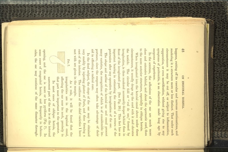 happens, cutting off its vascular and nervous continuations, and rendering it a structure more or less distinct. That under such circumstances it may be cut off, or subject to inflammation, suppuration, or even mortification, without giving rise to any symptoms of peritonitis, is an observation made long ago by surgeons of experience. In the scrotum, the adhesions of the sac are much more close and extensive behind, and about the spermatic cord, than to the more anterior structures, especially in oblique hernia. When invaginated into the hernial canal above under these circumstances, it usually drags up the cord with it and elevates the testicle. The circular fold or cul de sac, formed by invagination, is thus rendered necessarily deeper behind than in front of the invaginated part. (See Fig. 20.) This fact has an important bearing in estimating the causes of a return of the protrusion after any operation by invagination of the sac. The shape and outline of the hernial sac and canal present many varieties, the recognition of which is of considerable im- portance, since the surgeon may often take advantage of their aid in effecting a radical cure. In the dead subject, the shape of the sac may be obtained very readily by injecting plaster of Paris, and thus forming a cast of the interior. The outlines of the chief varieties I have met with are given in the margin. As a rule, it will be found that the irregularities are in the inguinal canal, affecting the sac near its neck, precisely in that part most important to the operator. In most cases of oblique hernia, the narrowest part of the sac is at the internal opening, and the sac is more or less pyriform (Fig. 7). In some cases of congenital hernia, and frequently in bubono- celes, the sac may continue of the same diameter through-