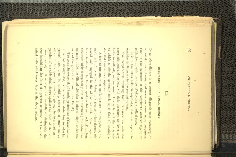 in. DIAGNOSIS OF INGUINAL HERNIA. IN no other disease is a correct diagnosis more necessary, or a mistake more glaring, and in certain cases more dangerous, than in the treatment of this complaint; whether urgent, or palliative, or with the view of effecting a radical cure. It is in the latter relation, especially, that it is proposed to consider its diagnosis in the present volume. The complications resulting from its association with the spermatic cord and testicle, with their coverings, render it very liable to difficulty in diagnosis. It may be said that the side to which a mistake generally tends is, to that of treating a doubtful tumour as a rupture. A hernial tumour, when small, is more or less globular, the most part of its surface being, in a greater or less degree, ob- scured and engaged in the abdominal wall. When large, it has a tendency to be flask-shaped; a distinct neck of uniform thickness fairly disappearing into and distending the abdominal opening, while the dilated globular fundus is lodged under the skin of the groin or scrotum. (See Fig. 4.) The great characteristic of hernial protrusions of the abdomen, when not strangulated, is the peculiar distending impulse im- pressed upon them by coughing, sneezing, or other sudden effort of the respiratory muscles; giving rise to a quick com- pression of the abdominal viscera against the sides of the con- taining cavity. It is important carefully to distinguish the true hernial impulse from the general impulsion of the abdo- minal walls which takes place in the above actions.