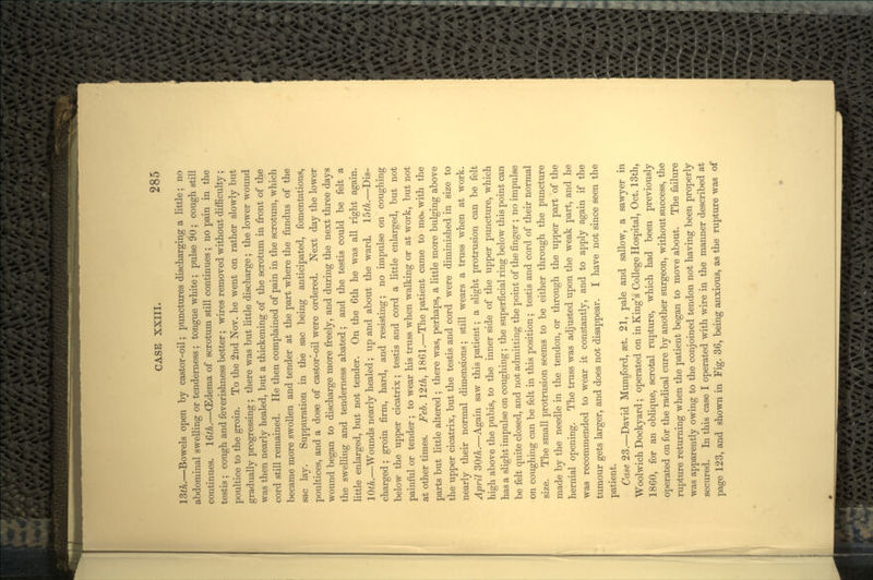 15th.—Bowels open by castor-oil; punctures discharging a little; no abdominal swelling or tenderness ; tongue white; pulse 90; cough still continues. 16th.—(Edema of scrotum still continues ; no pain in the testis ; cough and feverishness better; wires removed without difficulty; poultice to the groin. To the 2nd Nov. he went on rather slowly but gradually progressing ; there was but little discharge; the lower wound was then nearly healed, but a thickening of the scrotum in front of the cord still remained. He then complained of pain in the scrotum, which became more swollen and tender at the part where the fundus of the sac lay. Suppuration in the sac being anticipated, fomentations, poultices, and a dose of castor-oil were ordered. Next day the lower wound began to discharge more freely, and during the next three days the swelling and tenderness abated; and the testis could be felt a little enlarged, but not tender. On the 6th he was all right again. 10th.—Wounds nearly healed; up and about the ward. 15th.—Dis- charged ; groin firm, hard, and resisting; no impulse on coughing below the upper cicatrix; testis and cord a little enlarged, but not painful or tender ; to wear his truss when walking or at work, but not at other times. Feb. 12th, 1861.—The patient came to me- with the parts but little altered ; there was, perhaps, a little more bulging above the upper cicatrix, but the testis and cord were diminished in size to nearly their normal dimensions; still wears a truss when at work. April 30th.—Again saw this patient; a slight protrusion can be felt high above the pubis, to the inner side of the upper puncture, which has a slight impulse on coughing; the superficial ring below this point can be felt quite closed, and not admitting the point of the finger ; no impulse on coughing can be felt in this position; testis and cord of their normal size. The small protrusion seems to be either through the puncture made by the needle in the tendon, or through the upper part of the hernial opening. The truss was adjusted upon the weak part, and he was recommended to wear it constantly, and to apply again if the tumour gets larger, and does not disappear. I have not since seen the patient. Case 23.—David Mumford, get. 21, pale and sallow, a sawyer in Woolwich Dockyard; operated on in King's College Hospital, Oct. 13th, 1860, for an oblique, scrotal rupture, which had been previously operated on for the radical cure by another surgeon, without success, the rupture returning when the patient began to move about. The failure was apparently owing to the conjoined tendon not having been properly secured. In this case I operated with wire in the manner described at page 123, and shown in Fig. 36, being anxious, as the rupture was of