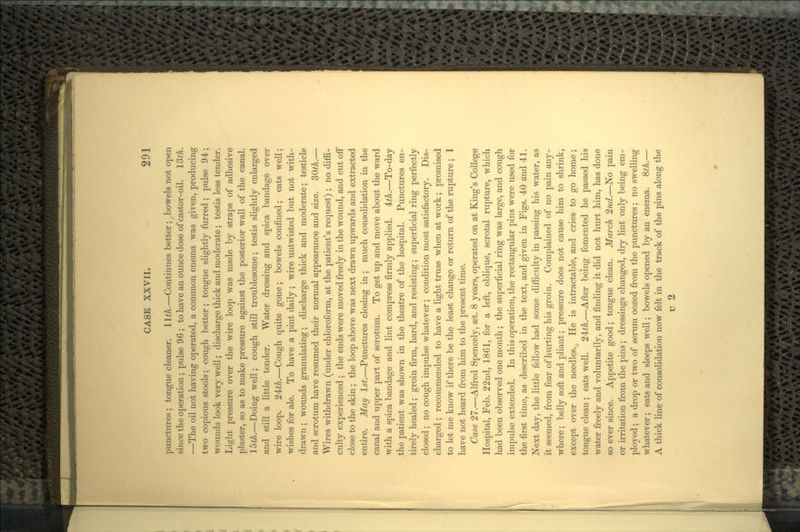 punctures; tongue cleaner, llth.—Continues better; bowels not open since the operation; pulse 96 ; to have an ounce dose of castor-oil. 13th. —The oil not having operated, a common enema was given, producing two copious stools; cough better ; tongue slightly furred ; pulse 94; wounds look very well; discharge thick and moderate ; testis less tender. Light pressure over the wire loop was made by straps of adhesive plaster, so as to make pressure against the posterior wall of the canal, 15th.—Doing well; cough still troublesome; testis slightly enlarged and still a little tender. Water dressing and spica bandage over wire loop. 24^.—Cough quite gone ; bowels confined; eats well; wishes for ale. To have a pint daily; wire untwisted but not with- drawn ; wounds granulating; discharge thick and moderate; testicle and scrotum have resumed their normal appearance and size. 30th.— Wires withdrawn (under chloroform, at the patient's request) ; no diffi- culty experienced ; the ends were moved freely in the wound, and cut off close to the skin; the loop above was next drawn upwards and extracted entire. May 1st.—Punctures closing in; much consolidation in the canal and upper part of scrotum. To get up and move about the ward with a spica bandage and lint compress firmly applied. £th.—To-day the patient was shown in the theatre of the hospital. Punctures en- tirely healed; groin firm, hard, and resisting; superficial ring perfectly closed; no cough impulse whatever; condition most satisfactory. Dis- charged ; recommended to have a light truss when at work; promised to let me know if there be the least change or return of the rupture ; I have not heard from him to the present time. Case 27.—Alfred Spencely, aet. 8 years, operated on at King's College Hospital, Feb. 22nd, 1861, for a left, oblique, scrotal rupture, which had been observed one month; the superficial ring was large, and cough impulse extended. In this operation, the rectangular pins were used for the first time, as described in the text, and given in Figs. 40 and 41. Next day, the little fellow had some difficulty in passing his water, as it seemed, from fear of hurting his groin. Complained of no pain any- where ; belly soft and pliant; pressure does not cause him to shrink, except over the needles. He is intractable, and cries to go home; tongue clean; eats well. 24^/L—After being fomented he passed his water freely and voluntarily, and finding it did not hurt him, has done so ever since. Appetite good; tongue clean. March 2nd.—No pain or irritation from the pins; dressings changed, dry lint only being em- ployed ; a drop or two of serum oozed from the punctures; no swelling whatever; eats and sleeps well; bowels opened by an enema. 8^.— A thick line of consolidation now felt in the track of the pins along the u 2