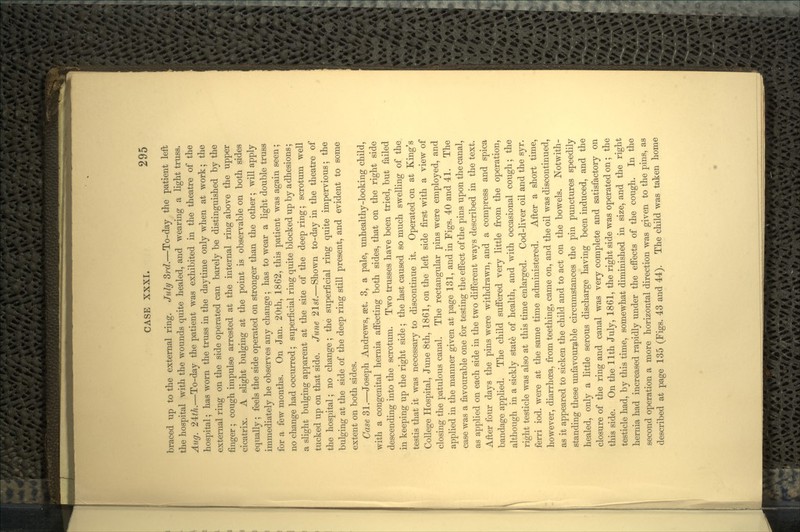 braced up to the external ring. July 3rd.—To-day the patient left the hospital with the wounds quite healed, and wearing a light truss. Aug. 24:th.—To-day the patient was exhibited in the theatre of the hospital; has worn the truss in the daytime only when at work; the external ring on the side operated can barely be distinguished by the finger; cough impulse arrested at the internal ring above the upper cicatrix. A slight bulging at the point is observable on both sides equally; feels the side operated on stronger than the other; will apply immediately he observes any change; has to wear a light double truss for a few months. On Jan. 20th, 1862, this patient was again seen; no change had occurred; superficial ring quite blocked up by adhesions; a slight bulging apparent at the site of the deep ring; scrotum well tucked up on that side. June 21st.—Shown to-day in the theatre of the hospital; no change; the superficial ring quite impervious; the bulging at the side of the deep ring still present, and evident to some extent on both sides. Case 31.—Joseph Andrews, set. 3, a pale, unhealthy-looking child, with a congenital hernia affecting both sides, that on the right side descending into the scrotum. Two trusses have been tried, but failed in keeping up the right side ; the last caused so much swelling of the testis that it was necessary to discontinue it. Operated on at King's College Hospital, June 8th, 1861, on the left side first with a view of closing the patulous canal. The rectangular pins were employed, and applied in the manner given at page 131, and in Figs. 40 and 41. The case was a favourable one for testing the effect of the pins upon the canal, as applied on each side in the two different ways described in the text. After four days the pins were withdrawn, and a compress and spica bandage applied. The child suffered very little from the operation, although in a sickly state of health, and with occasional cough; the right testicle was also at this time enlarged. Cod-liver oil and the syr. ferri iod. were at the same time administered. After a short time, however, diarrhrea, from teething, came on, and the oil was discontinued, as it appeared to sicken the child and to act on the bowels. Notwith- standing these unfavourable circumstances the pin punctures speedily healed, only a little serous discharge having been induced, and the closure of the ring and canal was very complete and satisfactory on this side. On the llth July, 1861, the right side was operated on; the testicle had, by this time, somewhat diminished in size, and the right hernia had increased rapidly under the effects of the cough. In the second operation a more horizontal direction was given to the pins, as described at page 135 (Figs. 43 and 44). The child was taken home