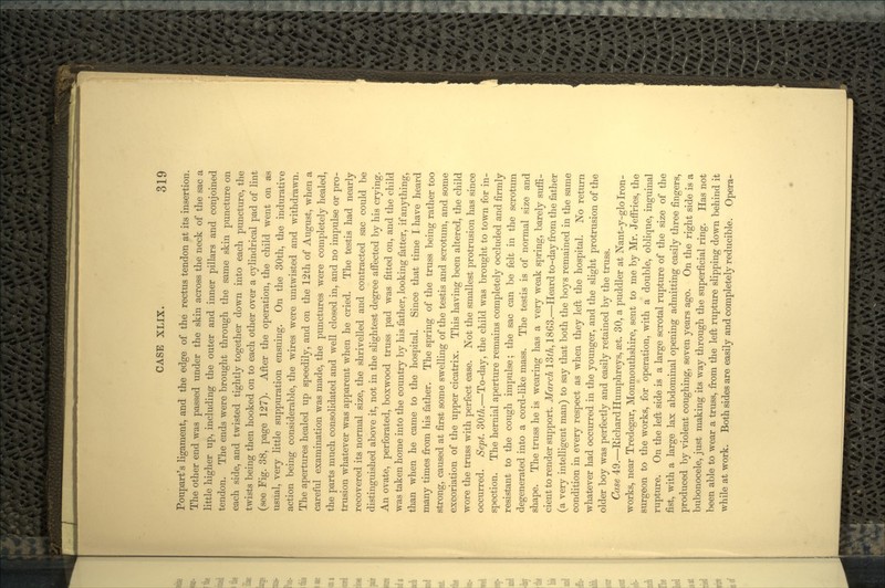Poupart's ligament, and the edge of the rectus tendon at its insertion. The other end was passed under the skin across the neck of the sac a little higher up, including the outer and inner pillars and conjoined tendon. The ends were brought through the same skin puncture on each side, and twisted tightly together down into each puncture, the twists being then hooked on to each other over a cylindrical pad of lint (see Fig. 38, page 127). After the operation, the child went on as usual, very little suppuration ensuing. On the 30th, the indurative action being considerable, the wires were untwisted and withdrawn. The apertures healed up speedily, and on the 12th of August, when a careful examination was made, the punctures were completely healed, the parts much consolidated and well closed in, and no impulse or pro- trusion whatever was apparent when he cried. The testis had nearly recovered its normal size, the shrivelled and contracted sac could be distinguished above it, not in the slightest degree affected by his crying. An ovate, perforated, boxwood truss pad was fitted on, and the child was taken home into the country by his father, looking fatter, if anything, than when he came to the hospital. Since that time I have heard many times from his father. The spring of the truss being rather too strong, caused at first some swelling of the testis and scrotum, and some excoriation of the upper cicatrix. This having been altered, the child wore the truss with perfect ease. Not the smallest protrusion has since occurred. Sept. 30th.—To-day, the child was brought to town for in- spection. The hernial aperture remains completely occluded and firmly resistant to the cough impulse; the sac can be felt in the scrotum degenerated into a cord-like mass. The testis is of normal size and shape. The truss he is wearing has a very weak spring, barely suffi- cient to render support. March 13th, 1863.—Heard to-day from the father (a very intelligent man) to say that both the boys remained in the same condition in every respect as when they left the hospital. No return whatever had occurred in the younger, and the slight protrusion of the older boy was perfectly and easily retained by the truss. Case 49.—Richard Humphreys, a3t. 30, a puddler at Nant-y-glo Iron- works, near Tredegar, Monmouthshire, sent to me by Mr. Jeffries, the surgeon to the works, for operation, with a double, oblique, inguinal rupture. On the left side is a large scrotal rupture of the size of the fist, with a large lax abdominal opening admitting easily three fingers, produced by violent coughing, seven years ago. On the right side is a bubonocele, just making its way through the superficial ring. Has not been able to wear a truss, from the left rupture slipping down behind it while at work. Both sides are easily and completely reducible. Opera-