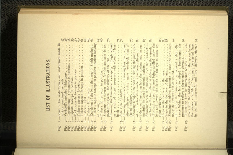 LIST OF ILLUSTRATIONS. Fig. i.—Some of the iridectomies and iridotomies made in various combined methods 47 Fig. 2.—Verhoeff's modified iridectomy 48 Fig. 3.—Capsulotomy. Cystotome in position 58 Fig. 4.—Capsule forceps in position 59 Fig. 5.—Tooke capsule forceps in position 59 Fig. 6.—Fisher's capsule forceps 60 Fig. 7.—Fisher's capsule forceps in position 61 Fig. 8.—Fisher's light 62 Fig. 9.—Fisher's lid retractor 63 Fig. 10.—Expulsion of the lens; first step in Smith method. . 64 Fig. ii.—Fisher's capsule forceps in position; patient looking at ceiling 65 Fig. 12.—Fisher's lid retractor in position 66 Fig. 13.—Showing the correct pose for the assistant in ex- posing the eyeball for delivery of the lens 70 Fig. 14.—Showing the lens-nucleus escaping through wound as a result of proper pressure with elbow of lens- hook 71 Fig. 15.—Side view of above 72 Fig. 16.—Showing convenience of removing lens from wound after delivery by using same lens-hook that ef- fected delivery 73 Fig. 17.—Showing Knapp's method of ridding the pupil space of soft cortex after nucleus has been delivered 82 Fig. 18.—Side view illustrating how the nucleus may be suc- cessfully delivered in unruly patients 83 Fig. 19.—Showing where the bulbous tip of the lens-hook is anplied in the first effort at delivery in the capsule. . 84 Fig. 20.—Illustrating deep pressure being applied below the lens and toward the depth of the eye to cause up- right delivery 86 Fig. 21.—Steps in the delivery of the lens 87 Fig. 22.—Steps in the delivery of the lens 88 Fig. 23.—Showing combined pressure in case the lens does not glide upwards out of wound 91 Fig. 24.—Illustrating the lens-spoon introduced a short dis- tance behind the lens to afford a background for pressure to relieve a threatening- vitreous 92 Fig. 25.—Illustrating how by increasing tension of the vit- reous with the added pressure of the spoon below the cornea a stubborn lens may be started from its bed and a successful and dry delivery effected 93