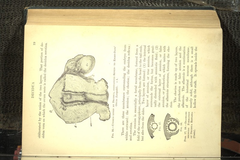 obliterated by the union of the two layers. That portion of de- cidua vera on which the ovum rests is called the decidua serotina. FIG. 16.—UTERUS LINED BY DECIDUA, CONTAINING SEVEN- TO EIGHT-DAYS' OVUM (Leopold). x 1. There are three membranes surrounding the embryo from within outward : the amnion; the chorion; the decidua reflexa ; and serotina. The amnion is essentially a foetal membrane, formed from a fold of the somatopleure, principally from the head to the tail ends, but also from the sides. Two layers are formed: (1) the internal layer of amnion, or true amnion, which surrounds the foetus, but becomes grad- ually distended with amniotic fluid; (2) the external layer of amnion, or false amnion, or prechorion, which unites with the allantoic structures, forming the cho- rion. The chorion is made up of two layers, the prechorion or false amnion and the allantois. The allantois is a continuation of the intestinal mucous membrane, mostly solid, although there is a small hollow in the stalk. It spreads inside the FIG. 17. FIG. 18. FIGS. 17, 18.—DIAGRAMS SHOWING FORMATION OF DECIDUA REFLEXA (Coste).