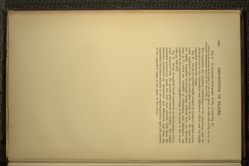 Fig. C. A composite photograph of Fig. A and Fig. B. Owing to an accidental inversion of one of the plates, the right side of Fig. B is in the composite superimposed upon the left side of Fig. A. This represents the combined contribution of the microscope and the observer's eye to the obfuscation and diffraction which mar the highly magnified microscopic image. Fig. D. Group of typhoid bacilli imaged by Gordon's tandem micro- scope employed with the ground glass screen at rest. We have here the highly magnified microscopic image relieved from the blemishes (seen in C) which are referable to obfuscation and diffraction, but marred by the superimposed magnified image of the grain of the screen (vide pp. 236-237). Fig. E. Group of typhoid bacilli imaged by Gordon's tandem micro- scope employed with the ground glass screen in motion. The highly magnified microscopic image has here been relieved both from the blemishes contributed by obfuscation and diffraction and from the superadded blemishes referable to the superimposition upon the picture of the magnified image of the grain of the screen.