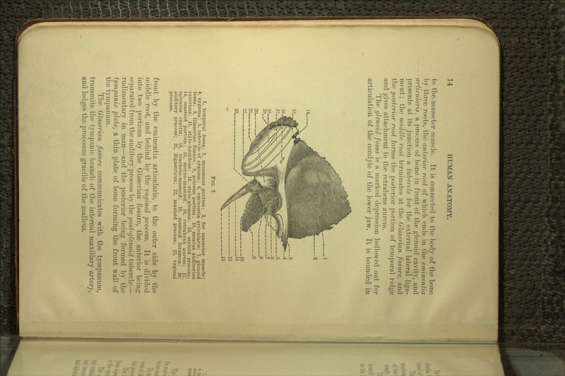 to the-masseter muscle. It is connected to the body of the bone by three roots, the anterior root of which ends in the eminentia articular is, a process of bone in front of the glenoid cavity, and presents at its junction a tubercle for the external lateral liga- ment; the middle root terminates at the Glaserian fissure, and the posterior root forms the posterior portion of temporal ridge and gives attachment to the retrahens aurem. The glenoid fossa is a marked depression hollowed out for articulation of the condyle of the lower jaw. It is bounded in 23. FIG. 7. 1, temporal fossa; 2, squamous portion; 3, for masseter muscle; 4, zygoma; 5, tubercle of zygoma; 6, eminentia articularis; 7, glenoid fossa; 8, Glaserian fissure; 9, petrous portion; 10, meatus auditorius externus; 11, stylo-hyoideus; 12, stylo-glossus; 13, styloid process; 14, mastoid portion; 15, sterno-mastoid; 16, retrahens aurem; 17, splenius capitis; 18, trachelo-mastoid; 19, mastoid foramen; 20, auditory process; 21, digastricus; 22, mastoid process; 23, vaginal process. front by the eminentia articularis, to the outer side by the middle root, and behind by the vaginal process. It is divided into two portions by the Glaserian fissure, the anterior being separated from the auditory process by the post-glenoid tubercle— rudimentary in man—and the posterior being formed by the tympanic plate, a thin plate of bone forming the front wall of the tympanum. The Glaserian fissure communicates with the tympanum, transmits the tympanic branch of the internal maxillary artery, and lodges the proccssus gracilis of the malleus.