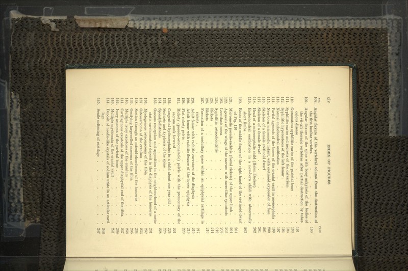 no. PAGE 108. Angular flexure of the vertebral column from the destruction of the first lumbar vertebra .... . 190 109. Angular flexure of the spine with bony ankylosis of the bodies of the vii-xii thoracic vertebrae after partial destruction by tuber- culous disease 191 110. Gummatous syphilitic caries of the parietal boue .... 193 111. Syphilitic caries and necrosis of the calvariuin .... 193 112. Syphilitic hyperostoses of the left femur 194 113. Normal endochondral ossification ....... 197 114. Partial agenesis of the bones of the cranial vault in anencephalia . 199 115. New-born micromelic infant, with cretinoid expression of face . 200 116. Skeleton of a female cretinoid dwarf 201 117. Skeleton of a female dwarf 201 118. Head of a microcephalic child (Helen Becker) .... 202 119. Endochondral ossification in a new-born child with abnormally short limbs 203 120. Bones of the middle finger of the right hand of the cretinoid dwarf of Fig. 116 204 121. Micromelic pseudo-rachitis (foetal rickets) of the upper limb . . 204 122. Agenesis of the wings of the sacrum with sacro-iliac synostosis . 205 123. Leontiasis ossea 208 124. Syphilitic osteochondritis 212 125. Rickets 214 126. Rickets 216 127. Formation of a medullary space within an epiphysial cartilage in rickets . 217 128. Adult femur with rachitic curvature of the diaphysis . . . 219 129. Adult femur with rachitic flexure of the lower epiphysis . . 219 130. Flat rickety pelvis 220 131. Rickety (pseudo-osteomalacic) pelvis with the promontory of the sacrum sunk forward . . .221 132. Congenital hydrocephalus in a child about one year old . . . 224 133. Scoliosis and kyphosis of the spine 226 134. Spondylolisthesis 228 135. Osseous resorption and apposition in the neighbourhood of a meta- static carcinomatous deposit in the diaphysis of the humerus . 231 136. Myelogenous osteosarcoma of the tibia 232 137. Osteosarcoma of the cranium 233 138. Section through an osteoid-chondroma of the humerus . . . 234 139. Ossifying large-celled sarcoma of the tibia 235 140. Multiple ivory exostoses of the cranium 236 141. Cartilaginous exostosis of the upper diaphysial end of the tibia . 237 142. Ivory osteoma of the parietal bone 238 143. Multiple myelomata of the cranial vault ...... 241 144. Deposit of needle-like crystals of sodium urate in an articular carti- lage , t . 246 145. Senile softening of cartilage 247