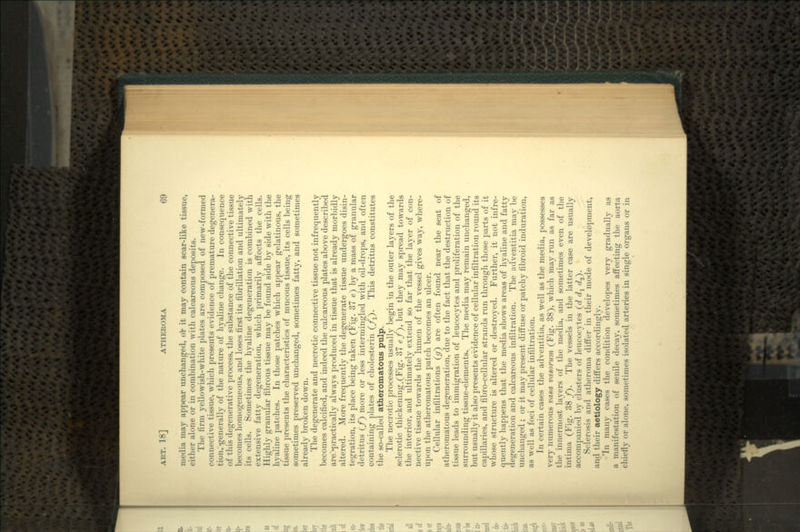 media may appear unchanged, or it may contain scar-like tissue, either alone or in combination with calcareous deposits. The firm yellowish-white plates are composed of new-formed connective tissue, which presents evidence of premature degenera- tion, -generally of the nature of hyaline change. In consequence of this degenerative process, the substance of the connective tissue becomes homogeneous, and loses first its fibrillation and ultimately its cells. Sometimes the hyaline degeneration is combined with extensive fatty degeneration, which primarily affects the cells. Highly granular fibrous tissue may be found side by side with the hyaline patches. In those patches which appear gelatinous, the tissue presents the characteristics of mucous tissue, its cells being sometimes preserved unchanged, sometimes fatty, and sometimes already broken down. The degenerate and necrotic connective tissue not infrequently becomes calcified, and indeed the calcareous plates above described are ^practically always produced in tissue that is already morbidly altered. More frequently the degenerate tissue undergoes disin- tegration, its place being taken (Fig. 37 e~) by a mass of granular detritus (/) more or less intermingled with oil-drops, and often containing plates of cholesterin (/j). This detritus constitutes the so-called atheromatous pulp. The necrotic processes usually begin in the outer layers of the sclerotic thickening.(Fig. 37 «/), but they may spread towards the interior, and ultimately extend so far that the layer of con- nective tissue towards the lumen of the vessel gives way, where- upon the atheromatous patch becomes an ulcer. Cellular infiltrations (#) are often found near the seat of atheromatous degeneration, due to the fact that the destruction of tissue leads to immigration of leucocytes and proliferation of the surrounding tissue-elements,. The media may remain unchanged, but usually it also presents evidence of cellular infiltration round its capillaries, and fibro-cellular strands run through those parts of it whose structure is altered or destroyed. Further, it not infre- quently happens that the media shows areas of hyaline and fatty degeneration and calcareous infiltration. The adventitia may be unchanged; or it may present diffuse or patchy fibroid induration, as well as foci of cellular infiltration. In certain cases the adventitia, as well as the media, possesses very numerous vasa vasorum (Fig. 38), which may run as far as the innermost layers of the media, and sometimes even of the intima (Fig. 38 f). The vessels in the latter case are usually accompanied by clusters of leucocytes (f? d1 c?2). Sclerosis and atheroma differ in their mode of development, and their aetiology differs accordingly. *In many cases the condition developes very gradually as a manifestation of senile decay, sometimes affecting the aorta chiefly or alone, sometimes isolated arteries in single organs or in