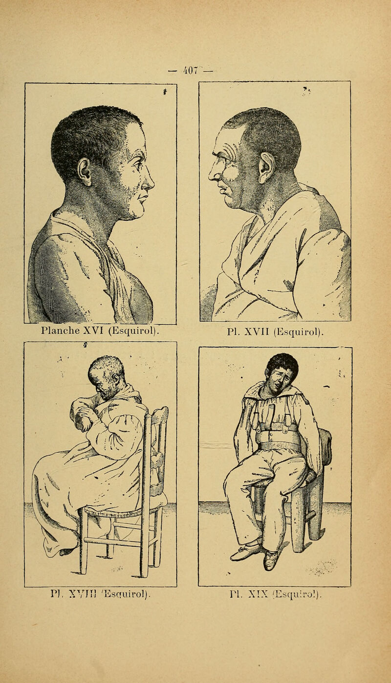 PI. XVII (Esquirol). 01 ( j /,-^M ^h ^ -- i fw \ \ ^^ 1 ^^S Y^.^-^^^ ^ / »-~3, m ^^ ■ \ r^ p P Î >it ►-, t 1 ■■■'•9f^_ ^S '§ È «r f C ^^. S^^V-^- P], XVIÎl 'Escruirol). n, XÎX (Esquii'o!)