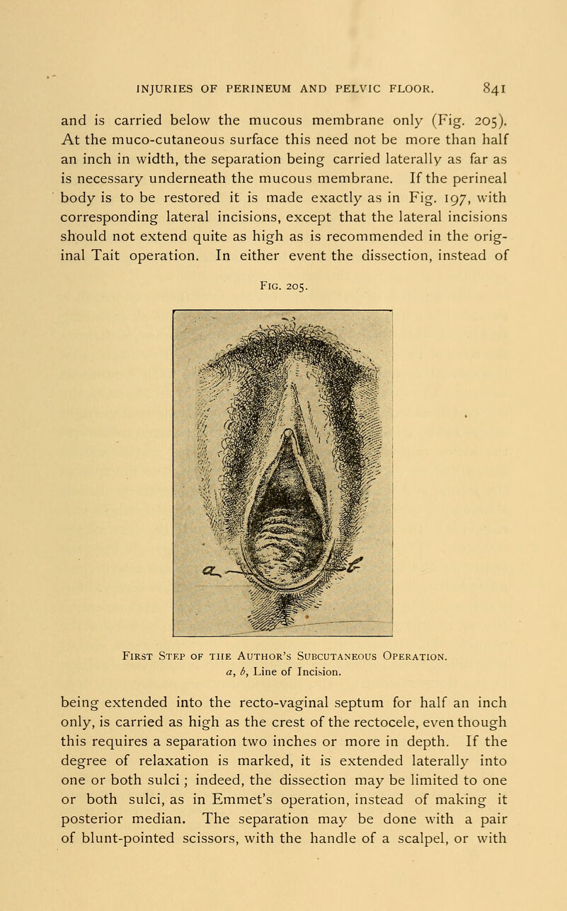 and is carried below the mucous membrane only (Fig. 205). At the muco-cutaneous surface this need not be more than half an inch in width, the separation being carried laterally as far as is necessary underneath the mucous membrane. If the perineal body is to be restored it is made exactly as in Fig. 197, with corresponding lateral incisions, except that the lateral incisions should not extend quite as high as is recommended in the orig- inal Tait operation. In either event the dissection, instead of Fig. 205. First Step of the Author's Subcutaneous Operation. a, b, Line of Incision. being extended into the recto-vaginal septum for half an inch only, is carried as high as the crest of the rectocele, even though this requires a separation two inches or more in depth. If the degree of relaxation is marked, it is extended laterally into one or both sulci; indeed, the dissection may be limited to one or both sulci, as in Emmet's operation, instead of making it posterior median. The separation may be done with a pair of blunt-pointed scissors, with the handle of a scalpel, or with