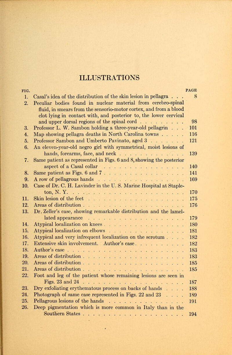 ILLUSTRATIONS FIG. PAGE 1. Casal's idea of the distribution of the skin lesion in pellagra ... 8 2. Peculiar bodies found in nuclear material from cerebro-spinal fluid, in smears from the sensorio-motor cortex, and from a blood clot lying in contact with, and posterior to, the lower cervical and upper dorsal regions of the spinal cord 98 3. Professor L. W. Sambon holding a three-year-old pellagrin . . . 101 4. Map showing pellagra deaths in North Carolina towns 116 5. Professor Sambon and Umberto Pavinato, aged 3 121 6. An eleven-year-old negro girl with symmetrical, moist lesions of hands, forearms, face, and neck 139 7. Same patient as represented in Figs. 6 and 8, showing the posterior aspect of a Casal collar 140 8. Same patient as Figs. 6 and 7 141 9. A row of pellagrous hands 169 10. Case of Dr. C. H. Lavinder in the U. S. Marine Hospital at Staple- ton, N. Y. . . . 170 11. Skin lesion of the feet 175 12. Areas of distribution 176 13. Dr. Zeller's case, showing remarkable distribution and the lamel- lated appearance 179 14. Atypical localization on knees 180 15. Atypical localization on elbows 181 16. Atypical and very infrequent localization on the scrotum .... 182 17. Extensive skin involvement. Author's case 182 18. Author's case 183 19. Areas of distribution 183 20. Areas of distribution 185 21. Areas of distribution 185 22. Foot and leg of the patient whose remaining lesions are seen in Figs. 23 and 24 187 23. Dry exfoliating erythematous process on backs of hands .... 188 24. Photograph of same case represented in Figs. 22 and 23 .... 189 25. Pellagrous lesions of the hands 191 26. Deep pigmentation which is more common in Italy than in the Southern States 194