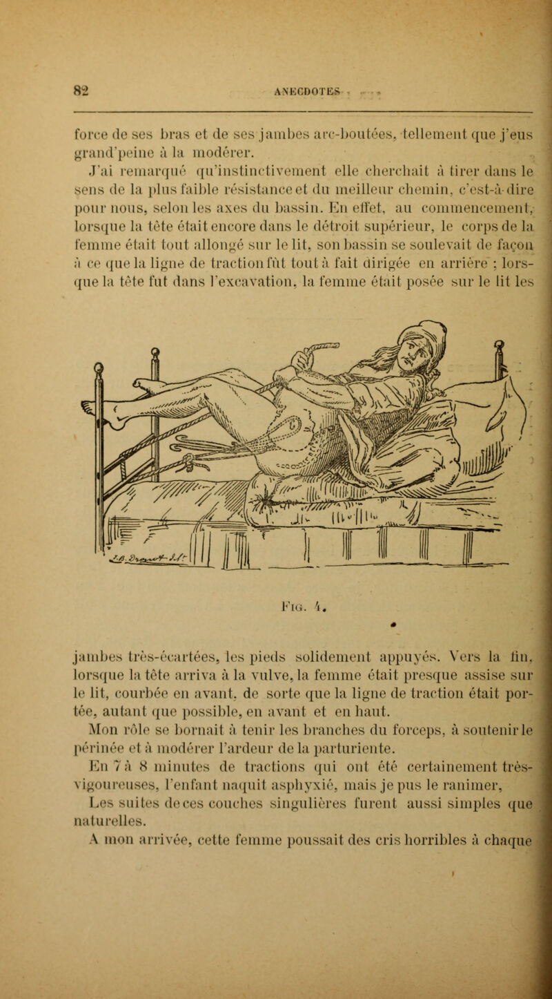 force «le ses bras ei de ses jambes arc-boutées, tellement que j'eus grand'peine à la modérer. .J'ai remarqué qu'instinctivement elle cherchait à tirer dans le sens de La pins faible résistanGeet du meilleur chemin, c'est-à-dire pour nous, selon les axes du bassin. En effet, au commencement, Lorsque la tête était encore dans le détroit supérieur, le corpsdela Femme étail tout allongé sur le lit> son bassin se soulevait de façon à ce que la ligne de traction fut tout à fait dirigée en arrière : lors- que la tête fut dans l'excavation, la femme étail posée sur le lit les Fïo. jambes très-écartées, les pieds solidement appuyés. Vers la lin. lorsque la tête arriva à la vulve, la femme était presque assise sur le lit, courbée en avant, do sorte que la ligne de traction était por- tée, autant que possible, en avant et en liant. Mon rôle se bornait à tenir les branches du forceps, à soutenir le périnée et à modérer l'ardeur de la parturiente. En î à x minnles de tractions qui ont été certainement très- vigoureuses, l'enfant naquit asphyxié, mais je pus le ranimer, Les suites de ces couches singulières furent aussi simples que naturelles. \ mon arrivée, cette femme poussail des cris horribles à chaque