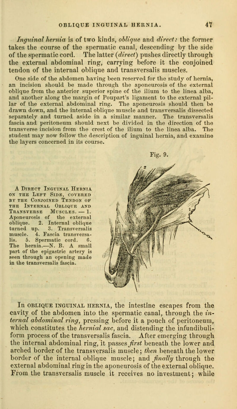 Inguinal hernia is of two kinds, oblique and direct: the former takes the course of the spermatic canal, descending by the side of tlie spermatic cord. The latter {direct) pushes directly through the external abdominal ring, carrying before it the conjoined tendon of the internal oblique and transversalis muscles. One side of the abdomen having been reserved for the study of hernia, an incision should be made through the aponeurosis of the external oblique from the anterior superior spine of the ilium to the linea alba, and another along the margin of Poupart's ligament to the external pil- lar of the external abdominal ring. The aponeurosis should then be drawn down, and the internal oblique muscle and transversalis dissected separately and turned aside in a similar manner. The transversalis fascia and peritoneum should next be divided in the direction of the transverse incision from the crest of the ilium to the linea alba. The student may now follow the description of inguinal hernia, and examine the layers concerned in its course. Fig. 9. A Direct Inguinal Hernia ON THE Left Side, covered Bv THE Conjoined Tendon op THE Internal Oblique and Transverse Muscles. — 1. Aponeurosis of the external oblique. 2. Internal oblique turned up. 3. Transversalis muscle. 4. Fascia transversa- lis. 5. Spermatic cord. 6. The hernia.—N. B. A small part of the epigastric artery is seen through an opening made in the transversalis fascia. In OBLIQUE INGUINAL HERNIA, the intestine escapes from the cavity of the abdomen into the spermatic canal, through the in- ternal abdominal ring, pressing before it a pouch of peritoneum, which constitutes the hernial sac, and distending the infundibuli- form process of the transversalis fascia. After emerging through the internal abdominal ring, it passes^rs< beneath the lower and arched border of the transversalis muscle; then beneath the lower border of the internal oblique muscle; aw^ finally iXwowgh. the external abdominal ring in the aponeurosis of the external oblique. From the transversalis muscle it receives no investment; while