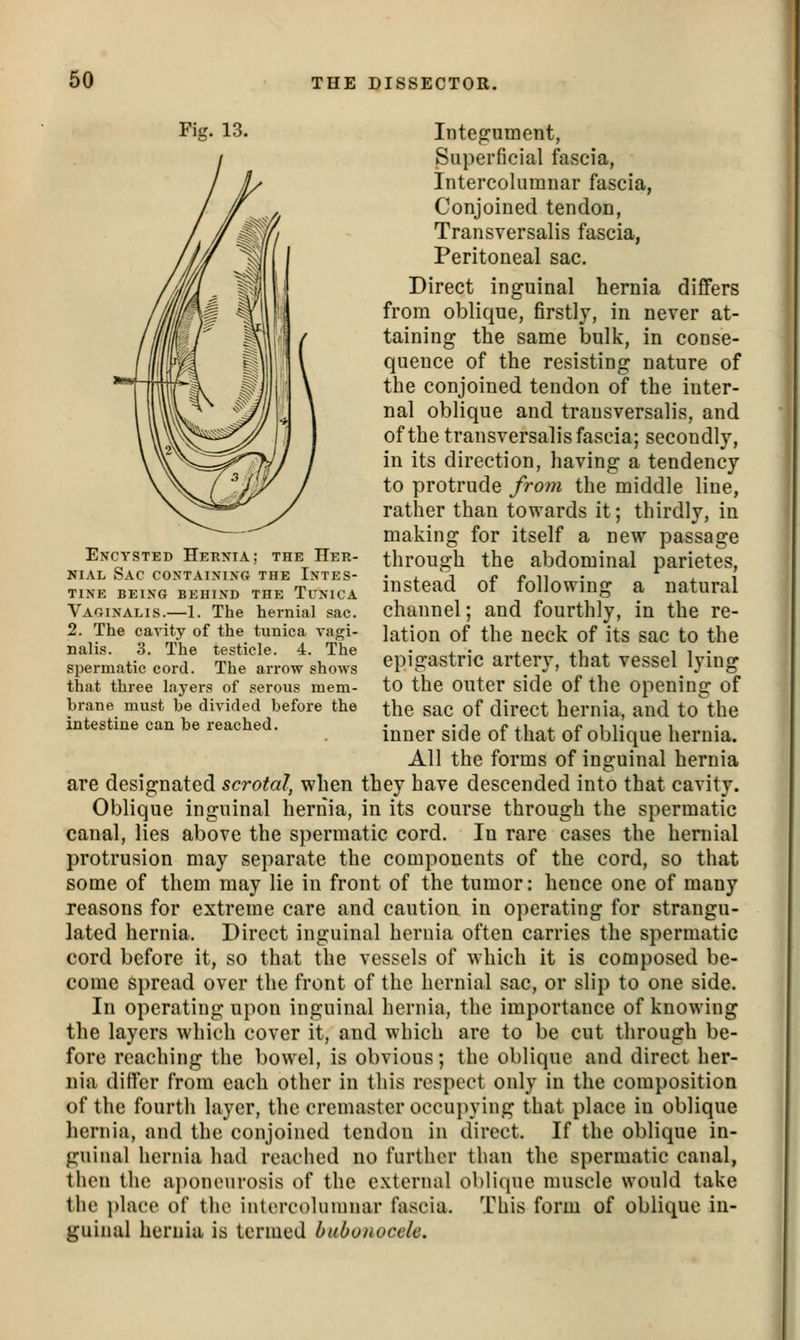Intep:ument, Superficial fascia, Intercolumnar fascia, Conjoined tendon, Transversalis fascia, Peritoneal sac. Direct inguinal hernia differs from oblique, firstly, in never at- taining the same bulk, in conse- quence of the resisting nature of the conjoined tendon of the inter- nal oblique and transversalis, and of the transversalis fascia; secondly, in its direction, having a tendency to protrude from the middle line, rather than towards it; thirdly, in making for itself a new passage through the abdominal parietes, instead of following a natural channel; and fourthly, in the re- lation of the neck of its sac to the epigastric artery, that vessel lying to the outer side of the opening of the sac of direct hernia, and to the inner side of that of oblique hernia. All the forms of inguinal hernia are designated scrotal, when they have descended into that cavity. Oblique inguinal hernia, in its course through the spermatic canal, lies above the spermatic cord. In rare cases the hernial protrusion may separate the components of the cord, so that some of them may lie in front of the tumor: hence one of many reasons for extreme care and caution in operating for strangu- lated hernia. Direct inguinal hernia often carries the spermatic cord before it, so that the vessels of which it is composed be- come spread over the front of the hernial sac, or slip to one side. In operating upon inguinal hernia, the importance of knowing the layers which cover it, and which are to be cut through be- fore reaching the bowel, is obvious; the oblique and direct her- nia differ from each other in this respect only in the composition of the fourth layer, the cremastcr occui>ying that place in oblique hernia, and the conjoined tendon in direct. If the oblique in- guinal hernia had reached no further than the spermatic canal, then the a])oneurosis of the external obli{|ne muscle would take the place of the intercolumnar fascia. This form of oblique in- guinal hernia is termed bubonocele. Encysted Herxia; the Her- nial Sac containing the Intes- tine BEING BEHIND THE TuNlCA Vaginalis.—1. The hernial sac. 2. The cavity of the tunica vagi- nalis. 3. The testicle. 4. The spermatic cord. The arrow shows that three laj'ers of serous mem- brane must be divided before the intestine can be reached.